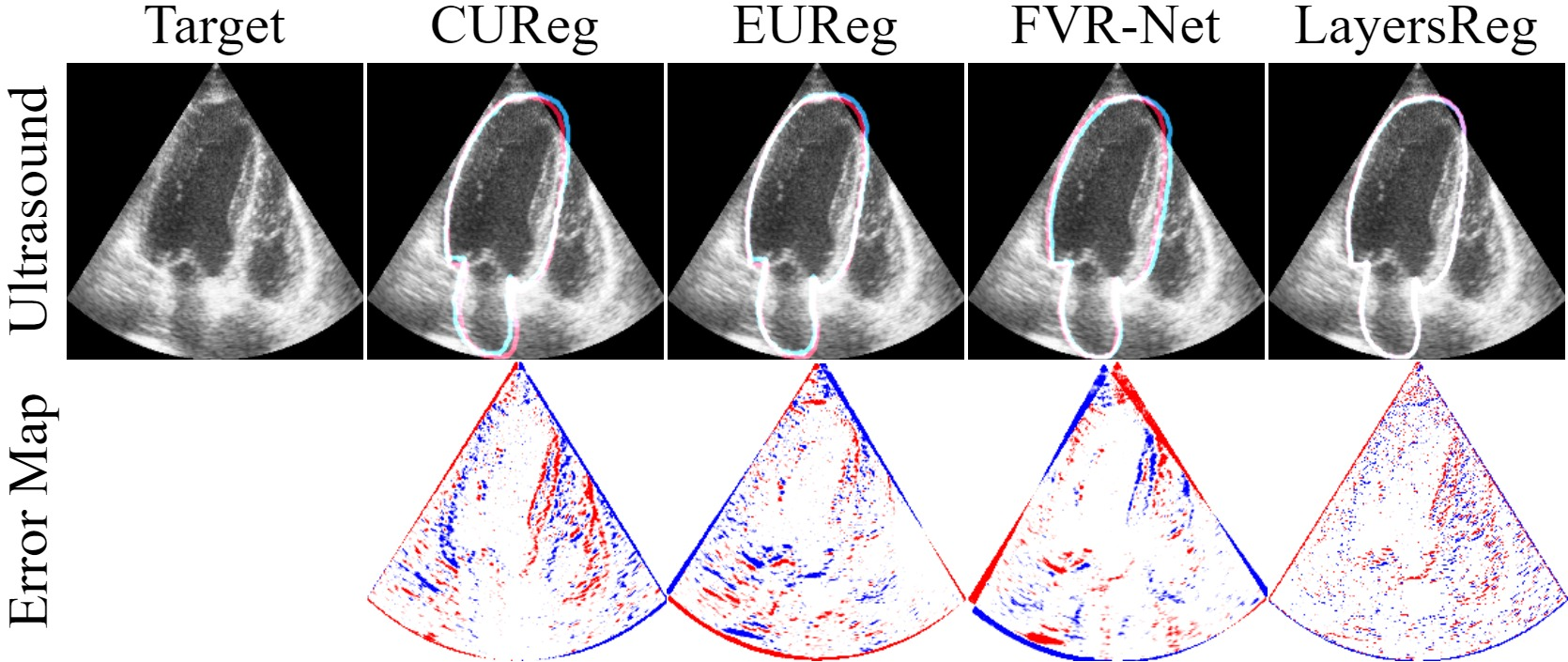 Figure 9: Slice localization comparison with ground truth on the CAMUS dataset, red is ground truth, blue is prediction.