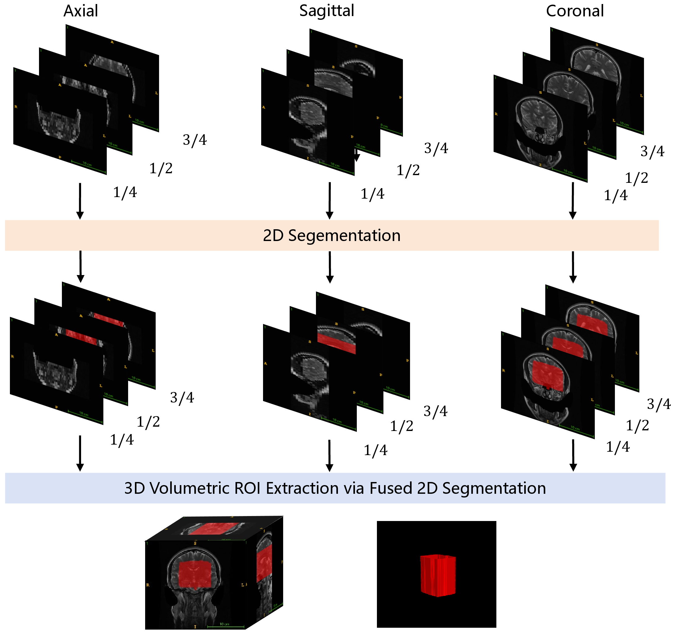 Figure 1: Overview of the Stage 1 tri-axial ROI extraction pipeline. A 2D nnU-Net processes slices sampled from three orthogonal axes; bounding box coordinates are extracted from each 2D prediction and averaged across axes to obtain the final 3D ROI.