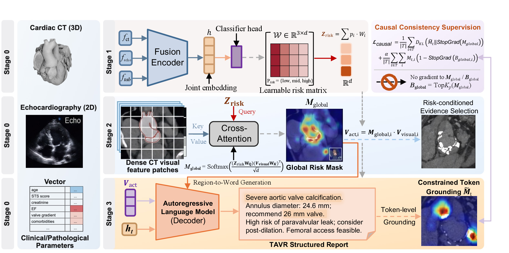 Figure 1: Overview of the TAVR-VLM architecture. R-CGA implements a model-internal “Risk \rightarrow Region \rightarrow Word” structural grounding pathway. Stage 1 encodes 3D CT, echocardiography clips, and clinical parameters into a joint embedding, predicts a risk distribution P_{\mathrm{risk}}, and constructs a causal risk bottleneck Z_{\mathrm{risk}}=P_{\mathrm{risk}}^{\top}W. Stage 2 uses Z_{\mathrm{risk}} as the query and CT visual tokens as key/value features to obtain a global risk mask M_{\mathrm{global}}, from which a risk-defined support mask B_{\mathrm{global}}=\mathrm{TopK}{\rho}
(M{\mathrm{global}}) is derived. Stage 3 generates the structured report from risk-activated visual features V_{\mathrm{act}} while projecting raw token attention M_t into B_{\mathrm{global}} to obtain the constrained token mask \widetilde{M}_t. The causal consistency loss aligns \widetilde{M}_t with the global risk mask and penalizes attention outside the risk-defined support.