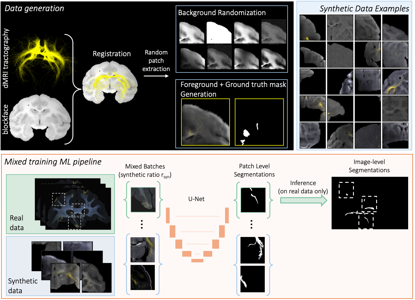 Figure 1: Overview of the proposed pipeline. Top: Ex vivo dMRI is registered to a blockface image from the same brain, and tractography streamlines from a cortical “injection site” are mapped into blockface space. We use subsets of these streamlines with varying fiber densities as the foreground, and compose them with randomized backgrounds to produce synthetic image–mask pairs. Bottom: Real histology patches and synthetic patches are mixed in each mini-batch with synthetic ratio r_{\text{syn}} to train a 2D U-Net. At inference, only real images are processed, and overlapping patch predictions are merged into full-section bundle segmentations.