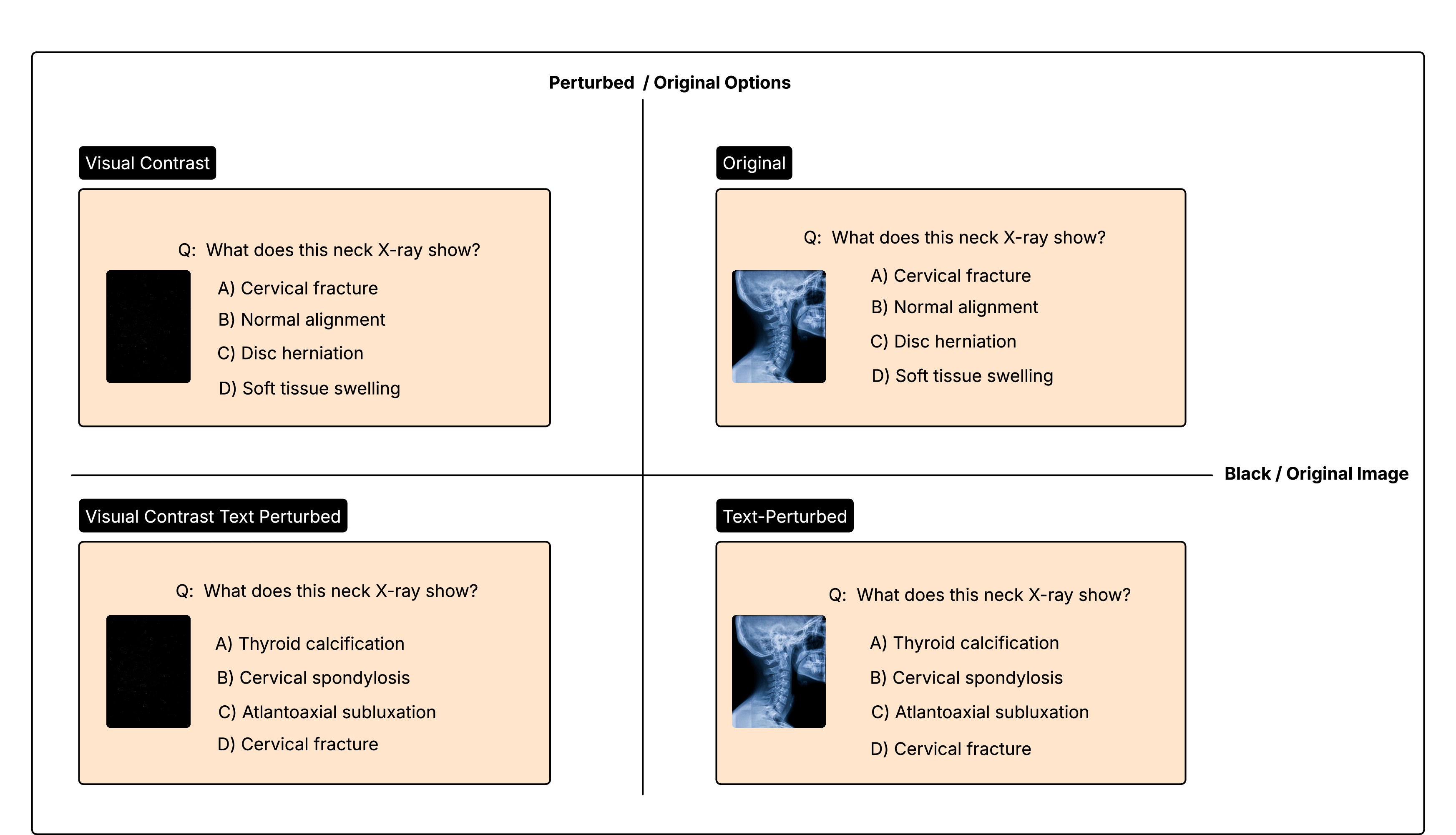 Figure 1: The 2\times2 factorial perturbation design illustrated on a cervical X-ray example from OmniMedVQA.