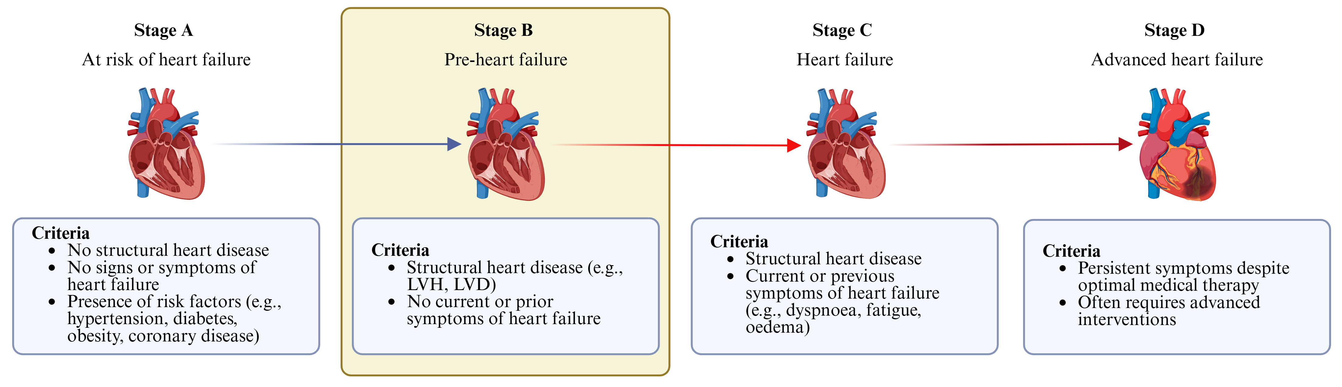 Figure 1: Heart failure stages. LVH: left ventricular hypertrophy; LVD: left ventricular dysfunction.