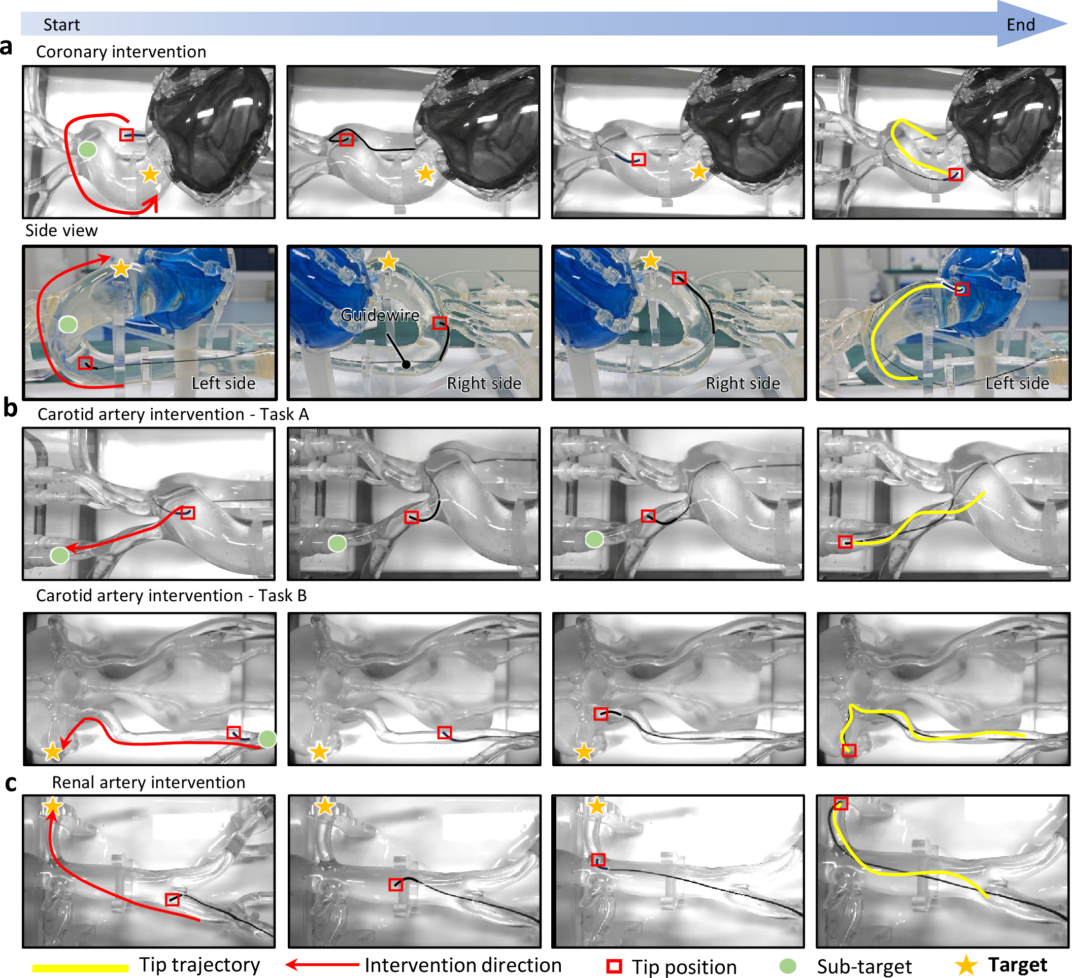 Figure 4: Experimental evaluation of the VL-PR framework in diverse vascular scenarios. Representative snapshots illustrate the procedural progression and context-aware navigation across: (a) coronary artery, (b) carotid artery, and (c) renal artery intervention scenarios. For each case, the guidewire trajectory is presented at critical time instants, demonstrating the ability of the proposed framework to interpret navigation contexts and achieve stable, goal-directed movement from initial insertion to the designated target vessel within complex and branching vascular structures.