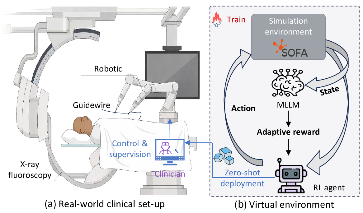 Figure 1: Overview of the clinical endovascular intervention scenario and the proposed learning framework. (a) Representative clinical setup of robotic endovascular navigation, where a guidewire is steered through complex vascular anatomies under imaging guidance. (b) Reinforcement learning training pipeline augmented with MLLM semantic reasoning, where high-level contextual understanding derived from vision-language observations informs policy learning. The learned navigation policy is subsequently deployed on the robotic platform without additional policy fine-tuning.