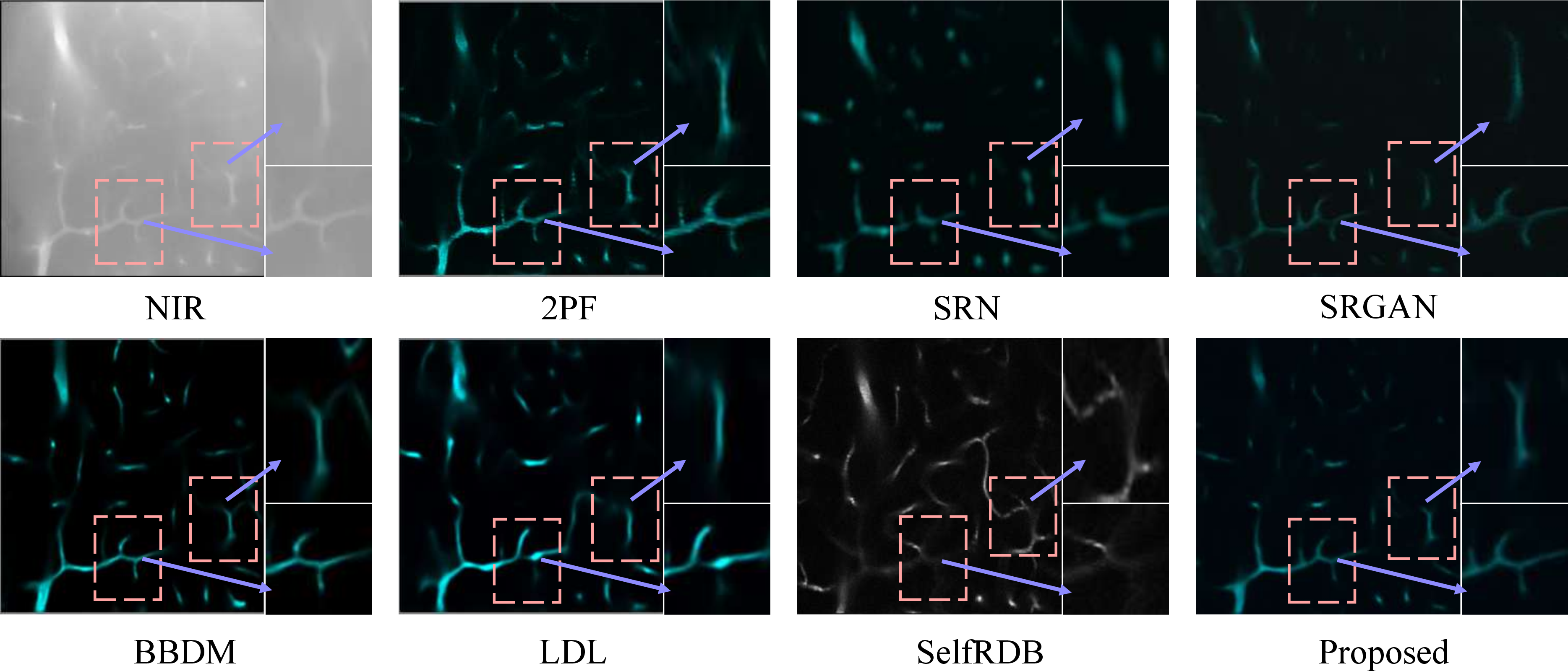 Figure 3: Visual comparison of vascular image translation results on the NIR2PF dataset. Existing methods show vessel breakage, over-smoothing, or spurious structures, whereas the proposed method preserves topologically consistent vascular reconstructions with clearer continuity.