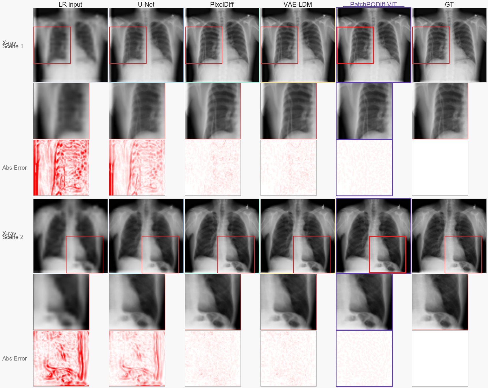 Figure 8: Qualitative comparison on Chest X-ray. Each scene shows (top) full reconstruction, (middle) zoomed region, and (bottom) absolute error. Columns correspond to LR input, U-Net, PixelDiff, VAE-LDM, Patch-PODiff-ViT, and ground truth. Patch-PODiff-ViT recovers sharper anatomical structures with lower reconstruction error, particularly along rib edges and lung boundaries.