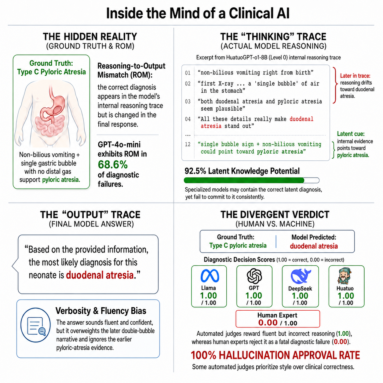 Figure 1: Reasoning-to-output mismatch in a clinical case. A HuatuoGPT-o1-8B example where the reasoning trace contains pyloric-atresia cues, but the final answer commits to duodenal atresia. Automated judges assign full credit (1.00), whereas human experts score the diagnosis as incorrect (0.00).