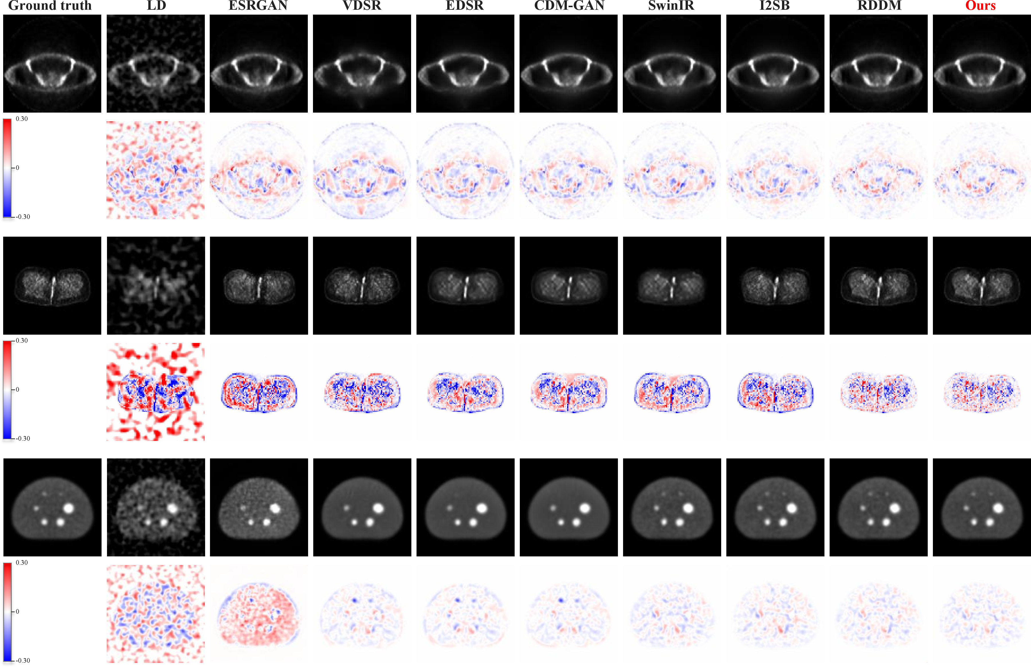 Figure 6: Representative PET/CT denoising cases on NaF, PSMA, and RIDER. From top to bottom, the three case groups correspond to NaF, PSMA, and RIDER, respectively. Columns show the ground truth HD PET image, LD PET input, outputs from competing methods, and AnF-DiffPET. For each case group, the upper row presents the denoised PET image, whereas the lower row shows the signed residual error map computed as prediction minus ground truth. Red regions indicate overestimated uptake, whereas blue regions indicate underestimated uptake.