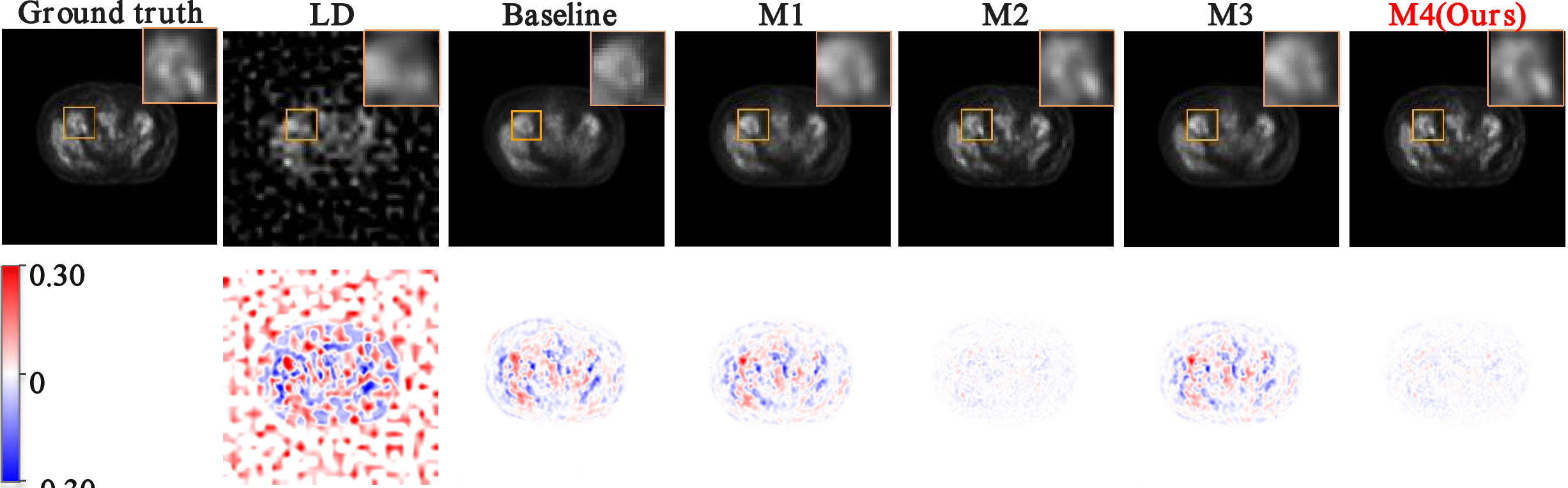 Figure 7: Representative ablation case with PET visualization. Columns show the ground truth HD PET image, LD PET input, the baseline model, and variants M1–M4, where M1–M4 correspond to +AFG, +AFG+MSCTR, +AFG+FCHM, and the complete AnF-DiffPET model, respectively. The upper row presents the denoised PET image with ROI zoom-in views (top-right insets) for detailed uptake visualization, whereas the lower row shows the signed residual error map computed as prediction minus ground truth. Red regions indicate overestimated uptake, whereas blue regions indicate underestimated uptake.