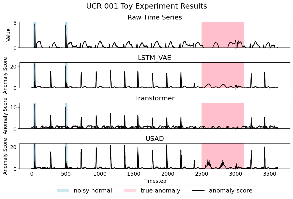 Figure 1: Raw time series of UCR 001 and anomaly score of each model where pink segments are anomalous timesteps