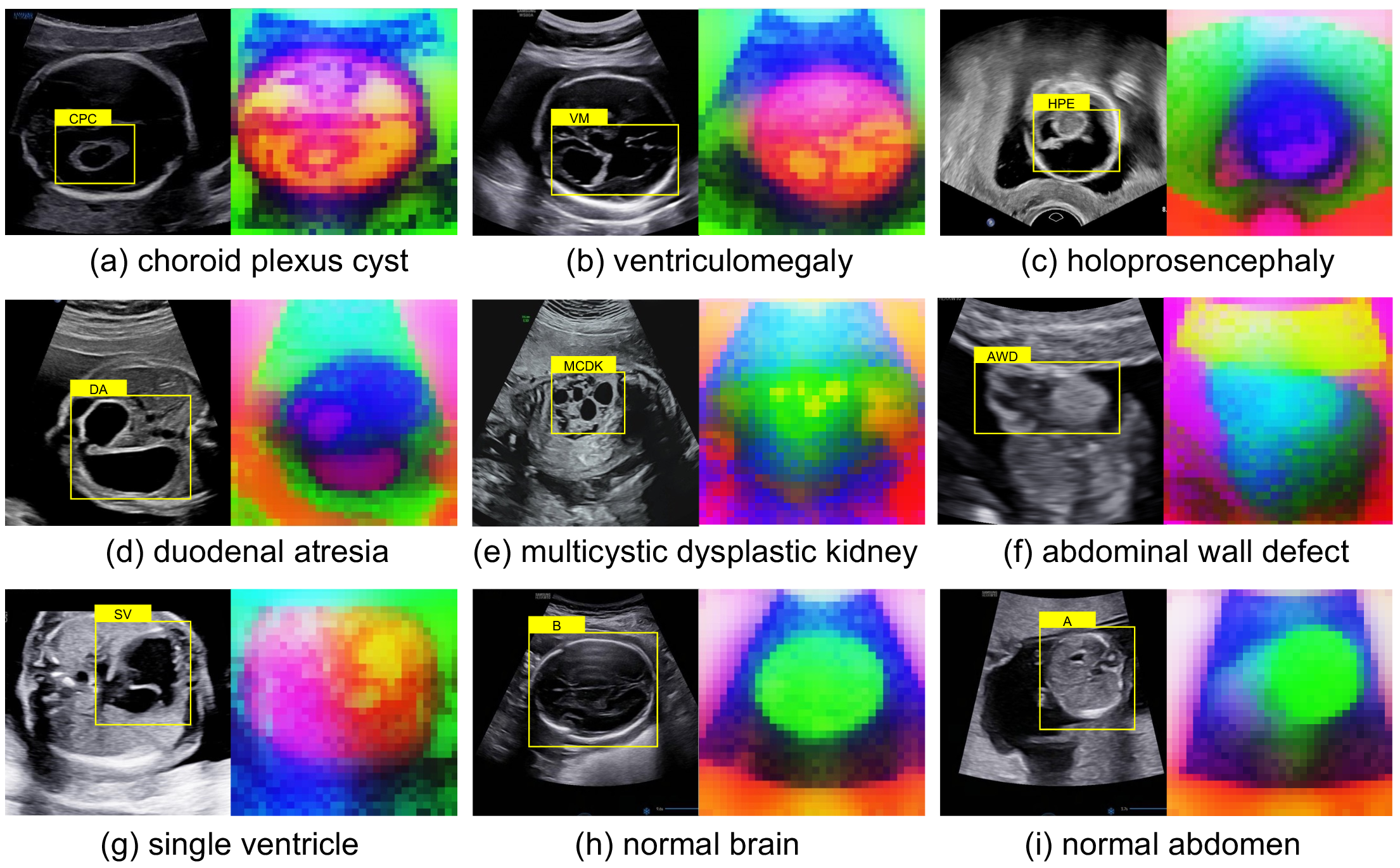 Figure 1: Visualization of DINO features. Each image (right) displays the first three principal components of the feature representation, mapped to RGB color channels. yellow boxes indicate region of interest.