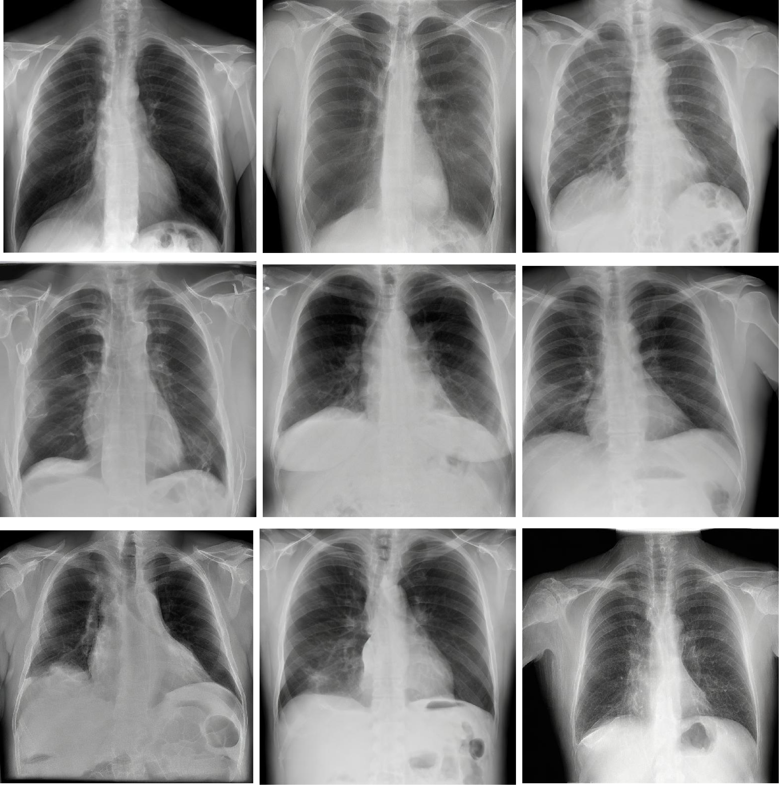 Figure 3: Synthetic chest X-ray images generated by a learnable text-guided diffusion model