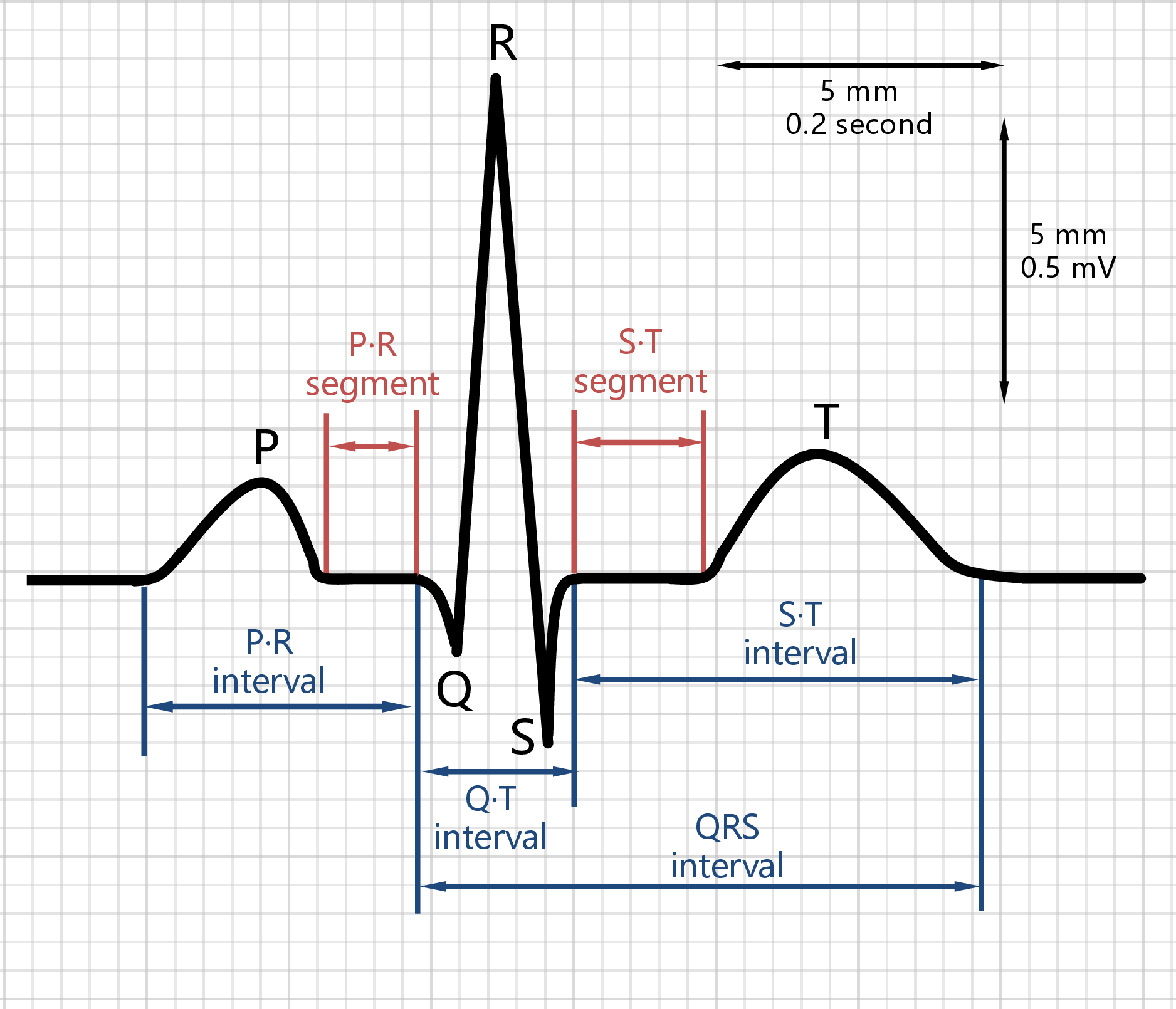 Figure 1: The composition of each wave cycle of electrocardiogram, including P wave, PR interval, QRS wave group, ST segment, T wave, QT interval, etc.