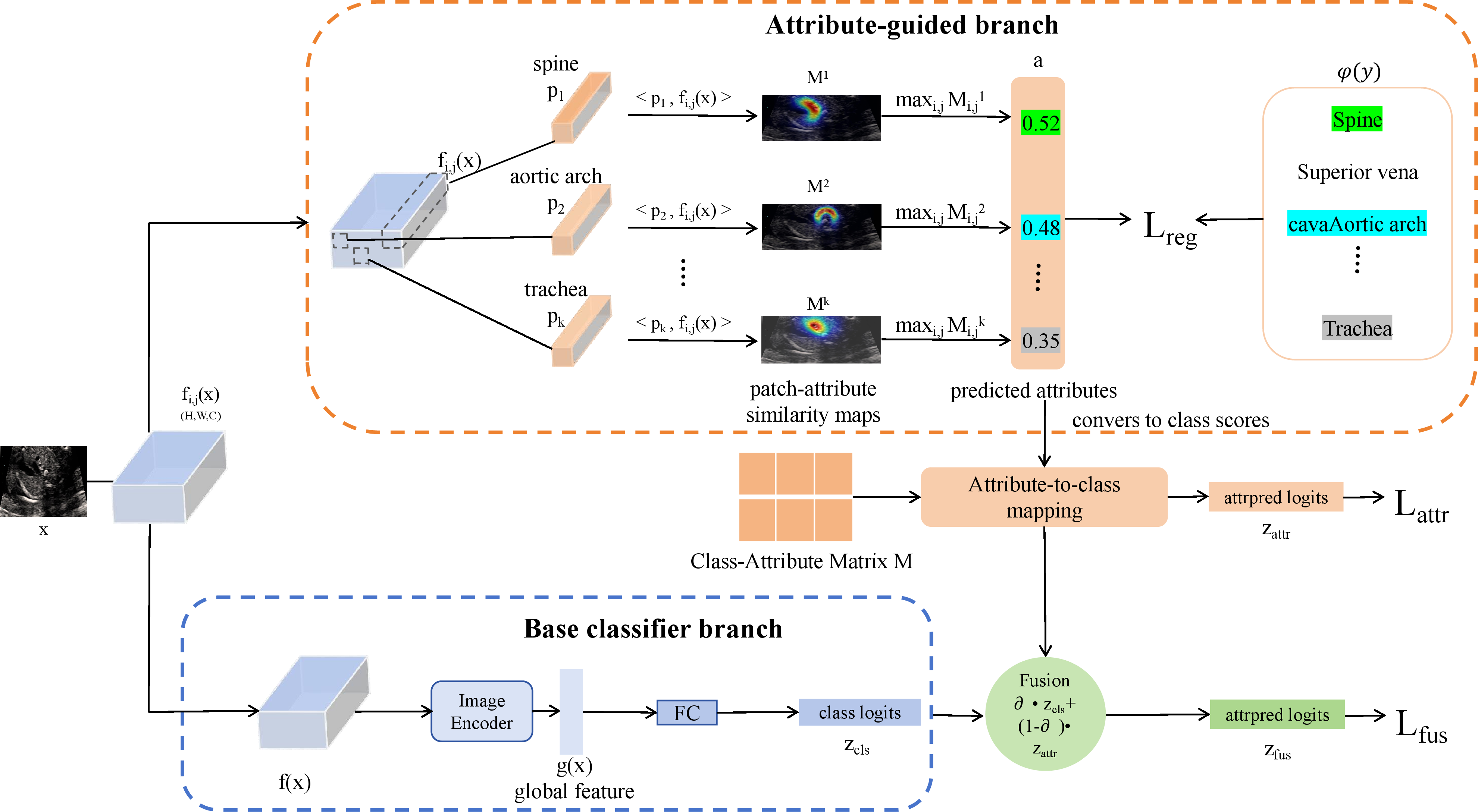 Figure 2: Overview of AttrGuide. Our plug-in module can be seamlessly integrated into existing ultrasound classifiers by reusing their encoder feature maps: a baseline branch follows the original encoder–classifier design, while an attribute-guided branch matches the same features with CLIP-derived attribute prototypes, aggregates them into attribute scores, maps them to class scores via a fixed class–attribute matrix, and is jointly optimized with the baseline prediction through classification and attribute-based regularization losses.