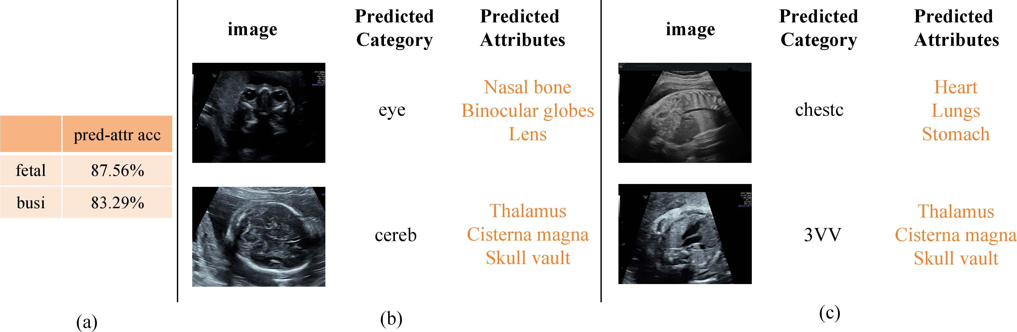 Figure 3: Interpretability via attribute prediction. (a) Pred-attr accuracy: fetal 87.56%, BUSI 83.29%. (b)–(c) Example cases.