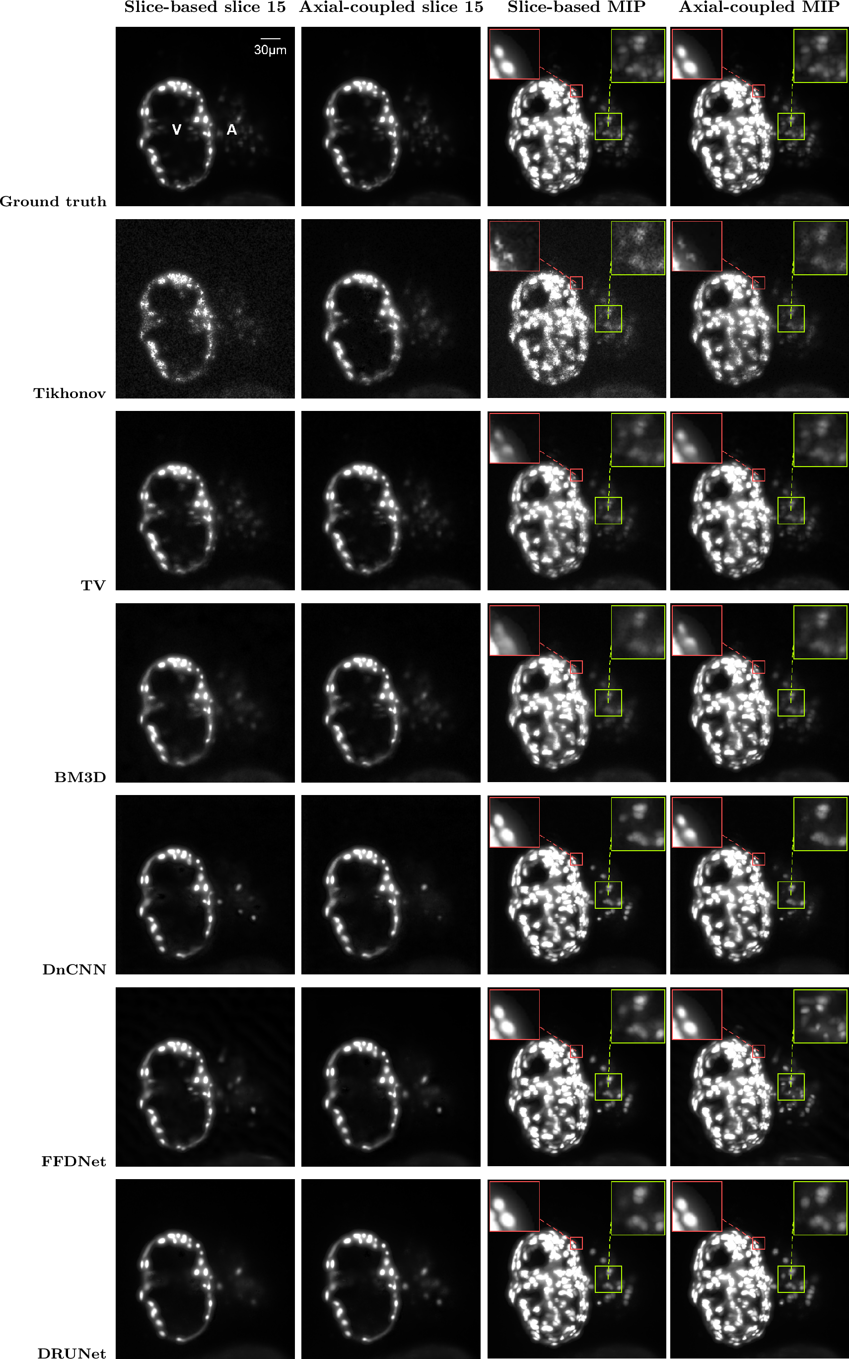 Figure 3: Qualitative comparison on synthetic data using a representative axial slice and MIP.
