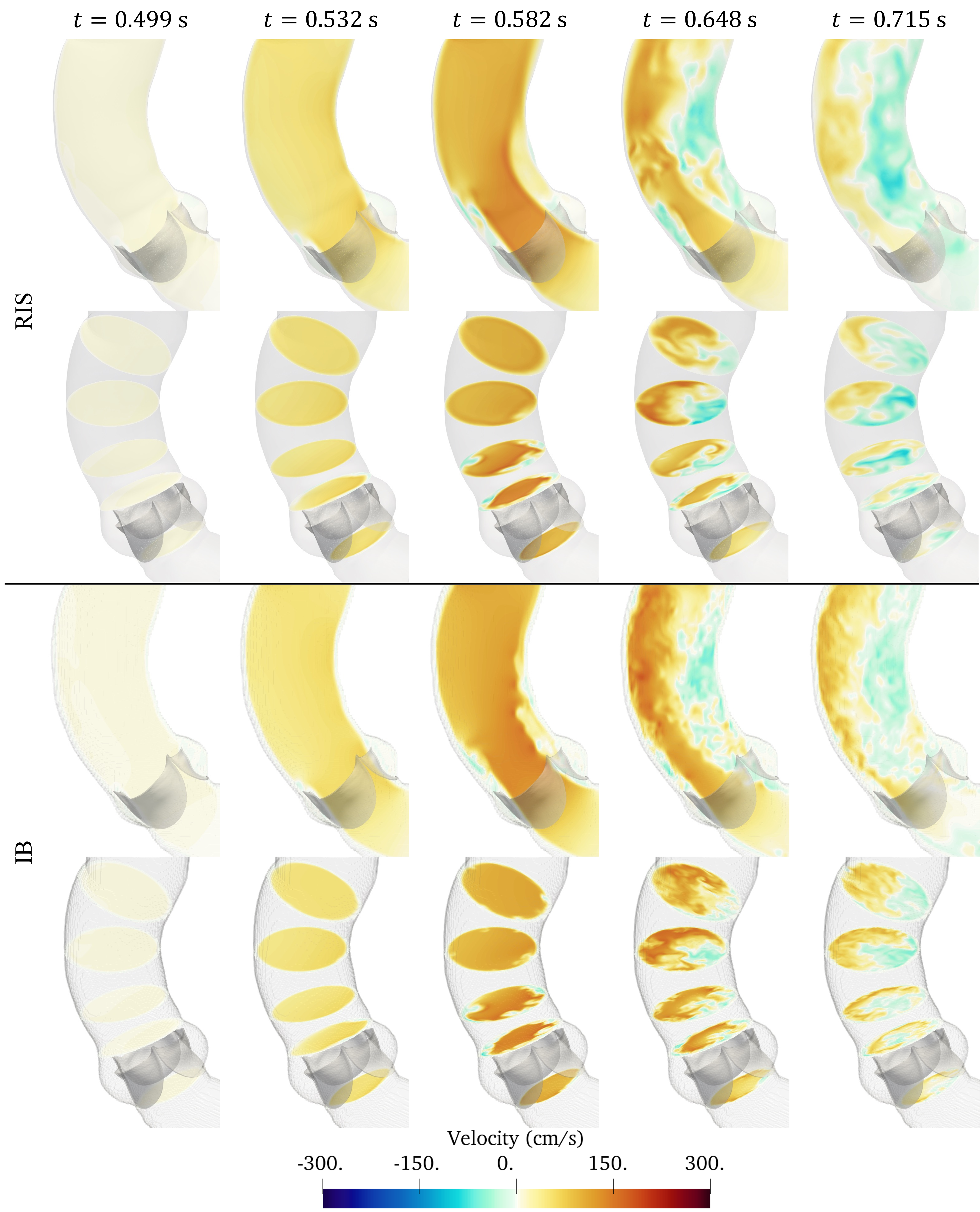 Figure 7: Comparison of the aortic flow velocity field in the vertical direction and bulk flow structures obtained with the RIS and IB methods when the aortic valve is fixed in the fully open position throughout the cardiac cycle.