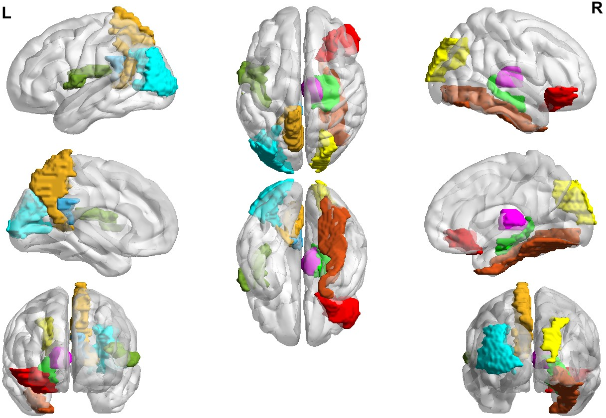 Figure 4: The visualization on discriminative ROIs for ASD Diagnosis.