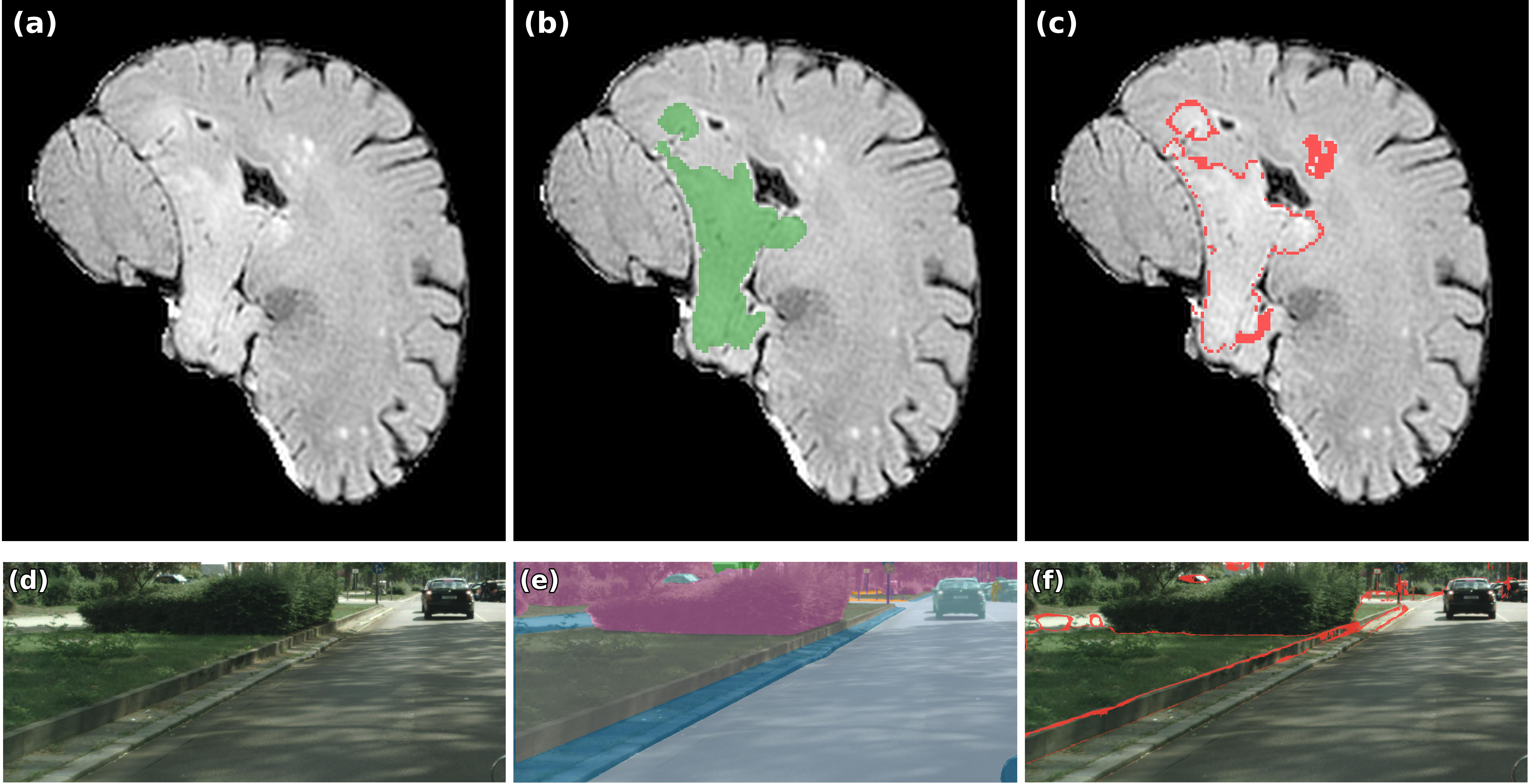 Figure 4: Spatial patterns of label flips under \mathrm{MS}(\bar{\mathbf{z}}) on BraTS and Cityscapes. Top row: BraTS example with (a) MRI slice, (b) ground-truth foreground mask (green), and (c) flipped voxels after calibration (red). Bottom row: Cityscapes example with (d) input image, (e) ground-truth semantic segmentation overlay, and (f) flipped pixels after calibration (red). The Cityscapes view is cropped for visualization. In both cases, flips are concentrated near semantic boundaries, indicating that non–argmax-preserving calibration induces structured local label changes rather than spatially uniform perturbations.