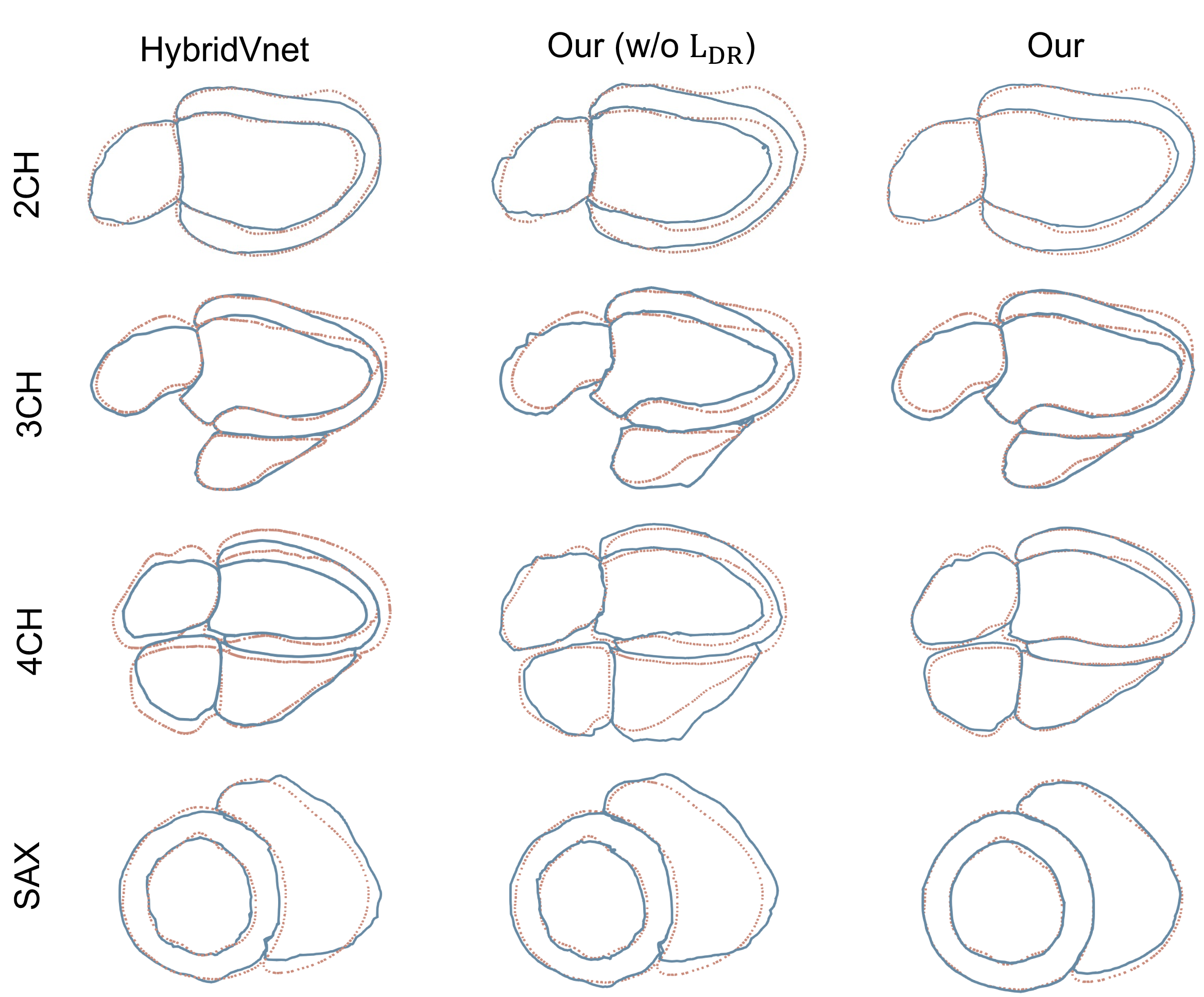 Figure 6: Qualitative comparison of multi-view contour alignment, where dash lines indicate ground truth and solid lines refer to estimated contours of different methods.