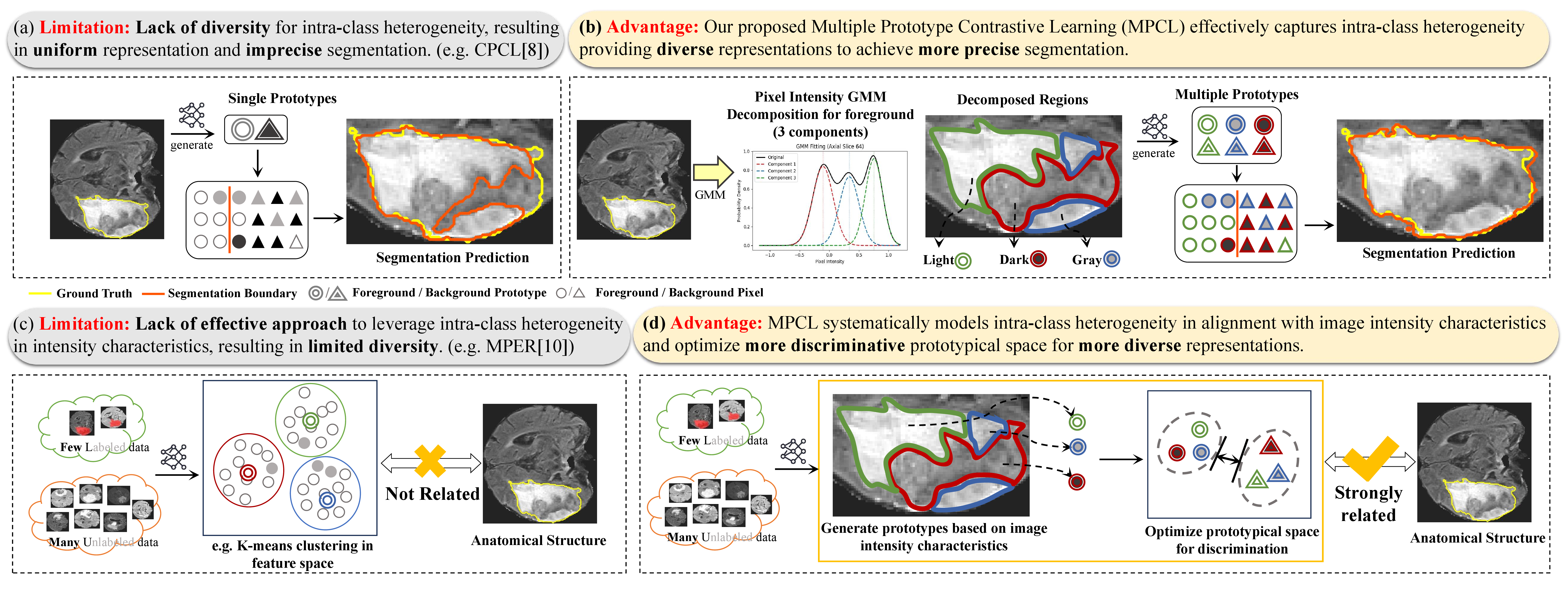 Figure 2: Limitations of the existing PL methods and the advantages of our MPCL that break through the bottleneck of the PL paradigm and achieve complete and precise segmentation results from limited labeled data. (a) and (c) are the limitations of the existing PL method. (b) and (d) are the corresponding solutions and advantages of our MPCL, respectively. (a) Existing methods only have single prototype for one representation. (b) Our MPCL has multiple prototypes to provide multiple representations and represent the intra-class heterogeneity. (c) Existing methods struggle to model heterogeneity. (d) Our MPCL systematically models intra-class heterogeneity according to image nature.