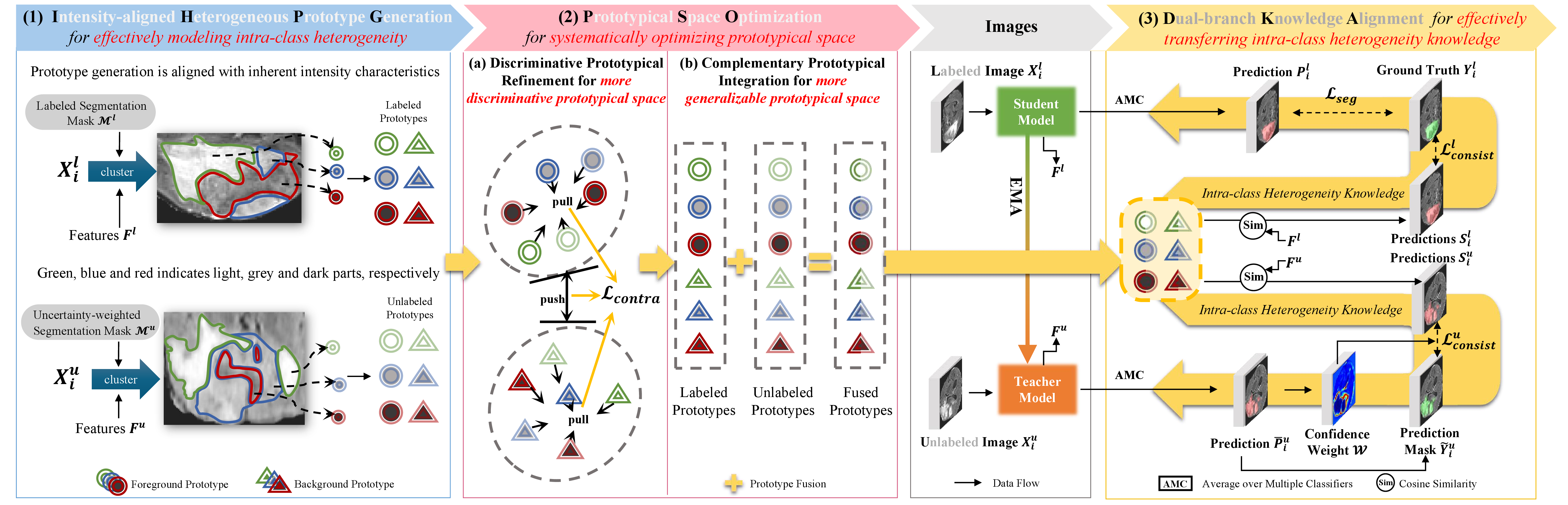 Figure 3: Overflow of our proposed method Multiple Prototypes Contrastive Learning (MPCL), which consists of three designs, including Intensity-aligned Heterogeneous Prototype Generation (IHPG) providing representations with better diversity via effectively modeling intra-class heterogeneity guided by intensity characteristics, Prototypical Space Optimization (PSO) systematically establishing a solid foundation for more precise segmentation via optimizing prototypical space to further enhance diversity and Dual-branch Knowledge Alignment (DKA) achieving segmentation results with better precision via efficiently transferring intra-class heterogeneity knowledge.