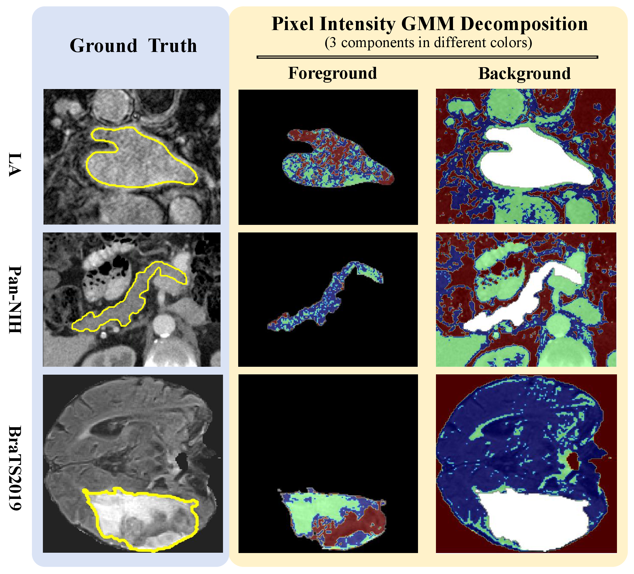 Figure 4: To demonstrate the improvement on segmentation precision via embracing intra-class heterogeneity, experiments are conducted on three datasets (LA, Pan-NIH, and BraTS2019) with intra-class heterogeneity on both foreground and background.