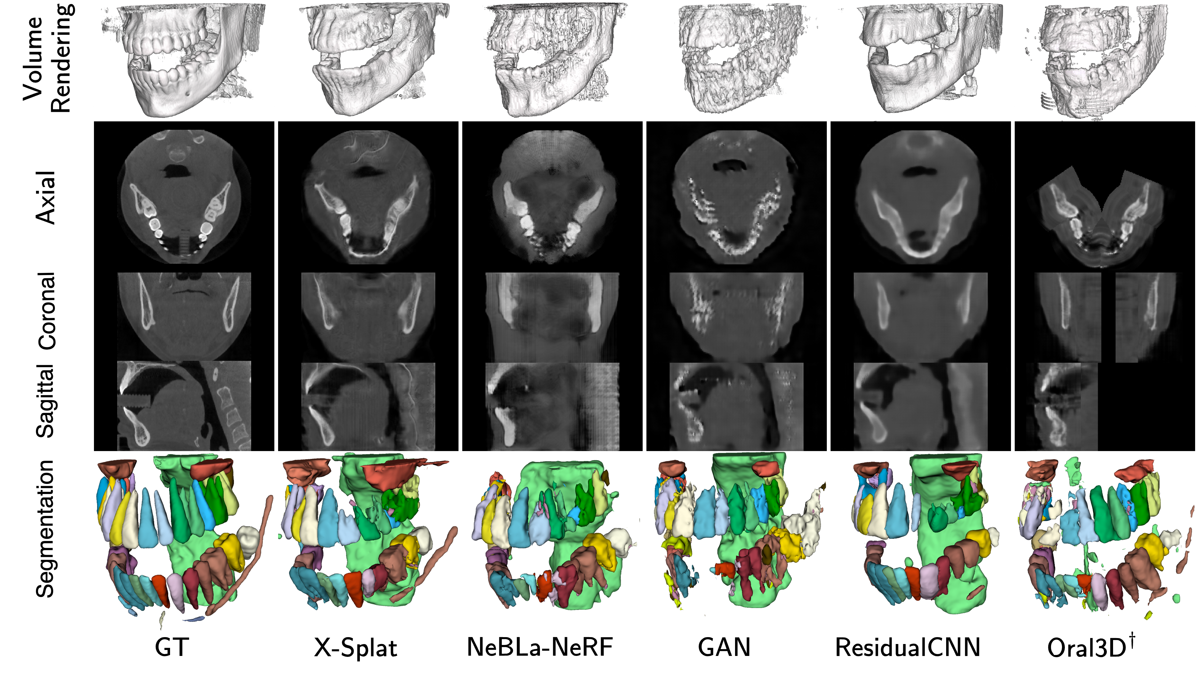 Figure 6: Supplementary qualitative comparison, case ID 027. ^\daggerOral-3D uses oracle arch geometry.