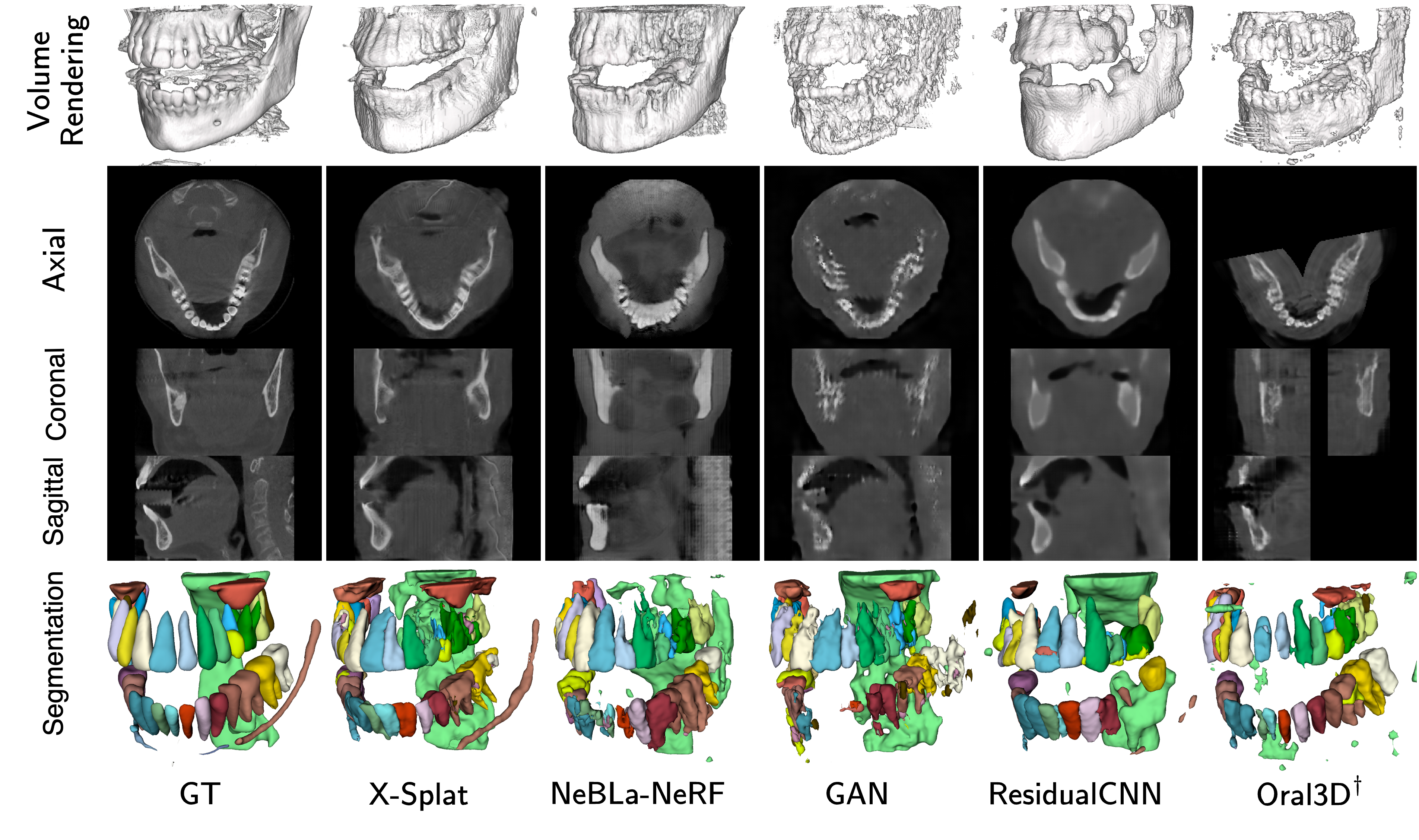 Figure 7: Supplementary qualitative comparison, case ID 030. ^\daggerOral-3D uses oracle arch geometry.
