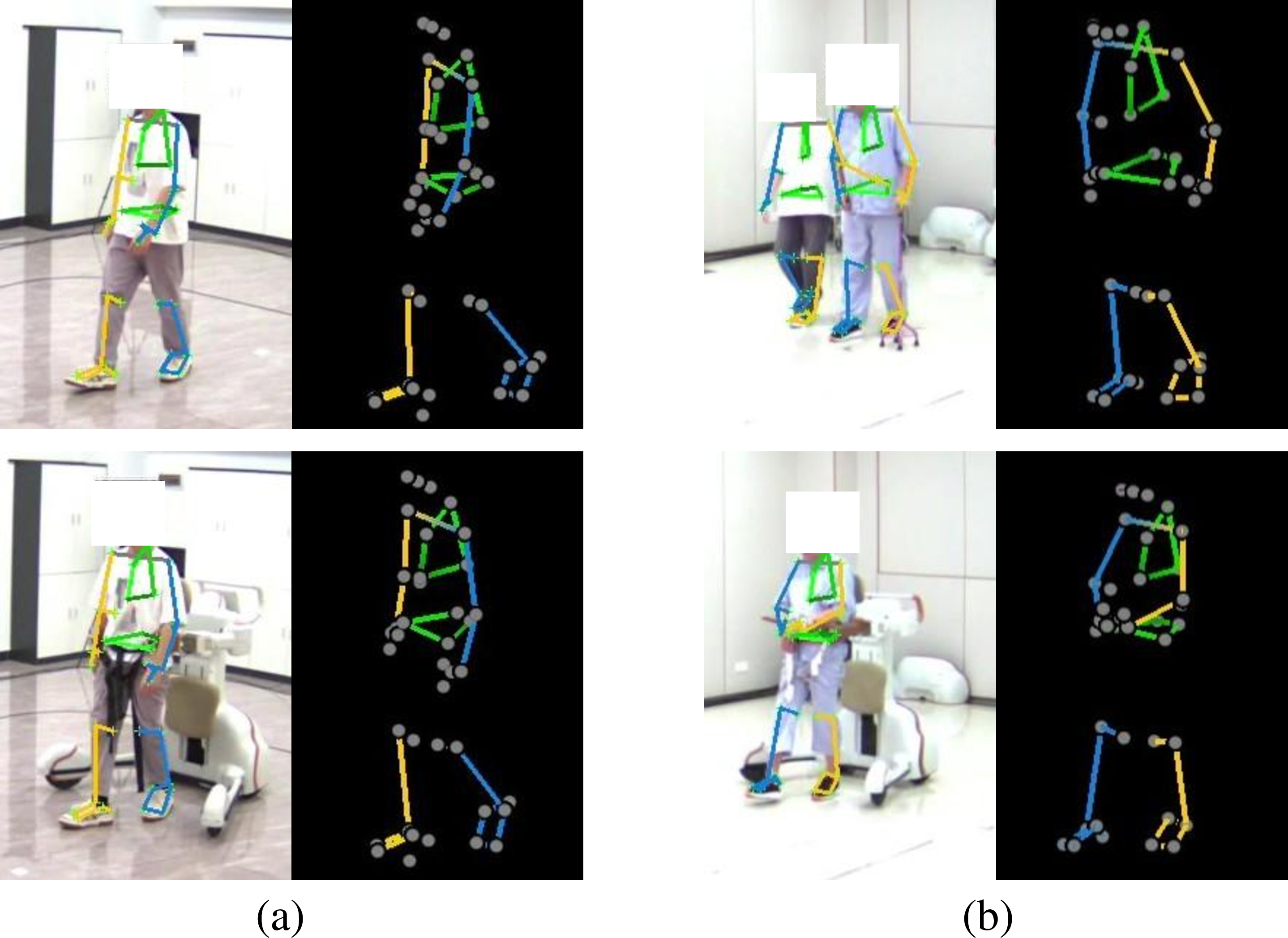 Figure 3: Experiment setup. (a) Transparency evaluation. Upper: healthy subject free walking. Lower: healthy subject walking with DRBA. (b) Effectiveness evaluation. Upper: patient assisted by a therapist. Lower: patient assisted by DRBA.
