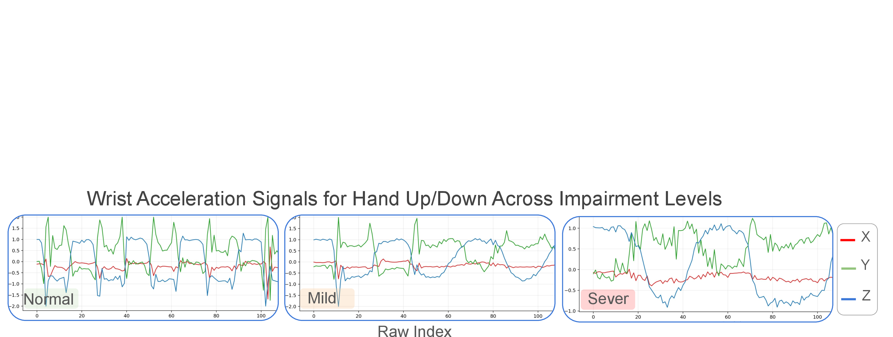 Figure 3: Representative wrist IMU acceleration signals for the Hand Up/Down task across different impairment levels.