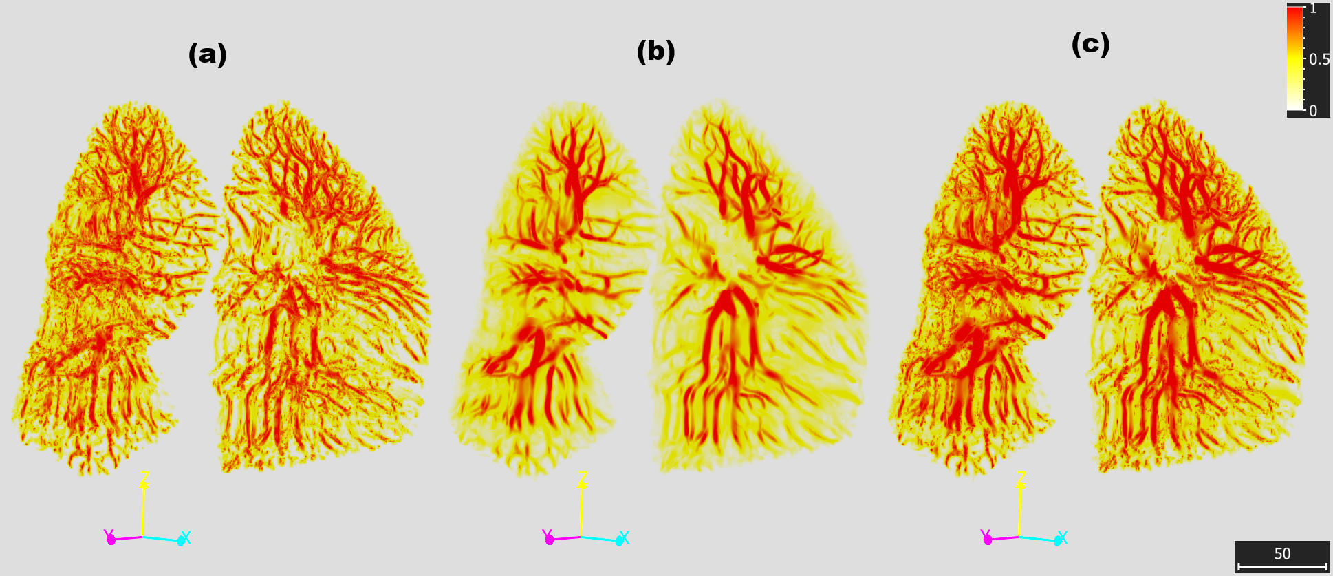 Figure 2: Side-by-side comparison of the two base vesselness responses and their fusion. (a) Frangi: performs well at highlighting thin, distal branches and preserves a dense network of peripheral vessels close to the pleura. However, it struggles to maintain continuity along the larger arteries, which occasionally appear fragmented rather than continuous tubes. (b) Sato: performs noticeably worse on the smallest distal branches but reconstructs the larger central arteries much more reliably. (c) Fused: fusion combines Frangi’s sensitivity to small peripheral vessels with Sato’s continuity on large central ones, producing a single probability field in which both the main pulmonary arteries and the distal branches are simultaneously better represented.