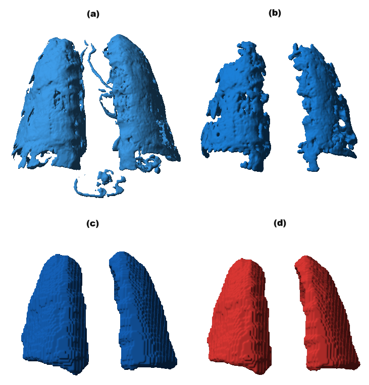 Figure 1: Four stages of lung segmentation pipeline, shown as 3D surfaces of the corresponding binary masks. (a) HU thresholding, (b) Airway disconnection, (c) Chan–Vese refinement, (d) EDT exclusion.