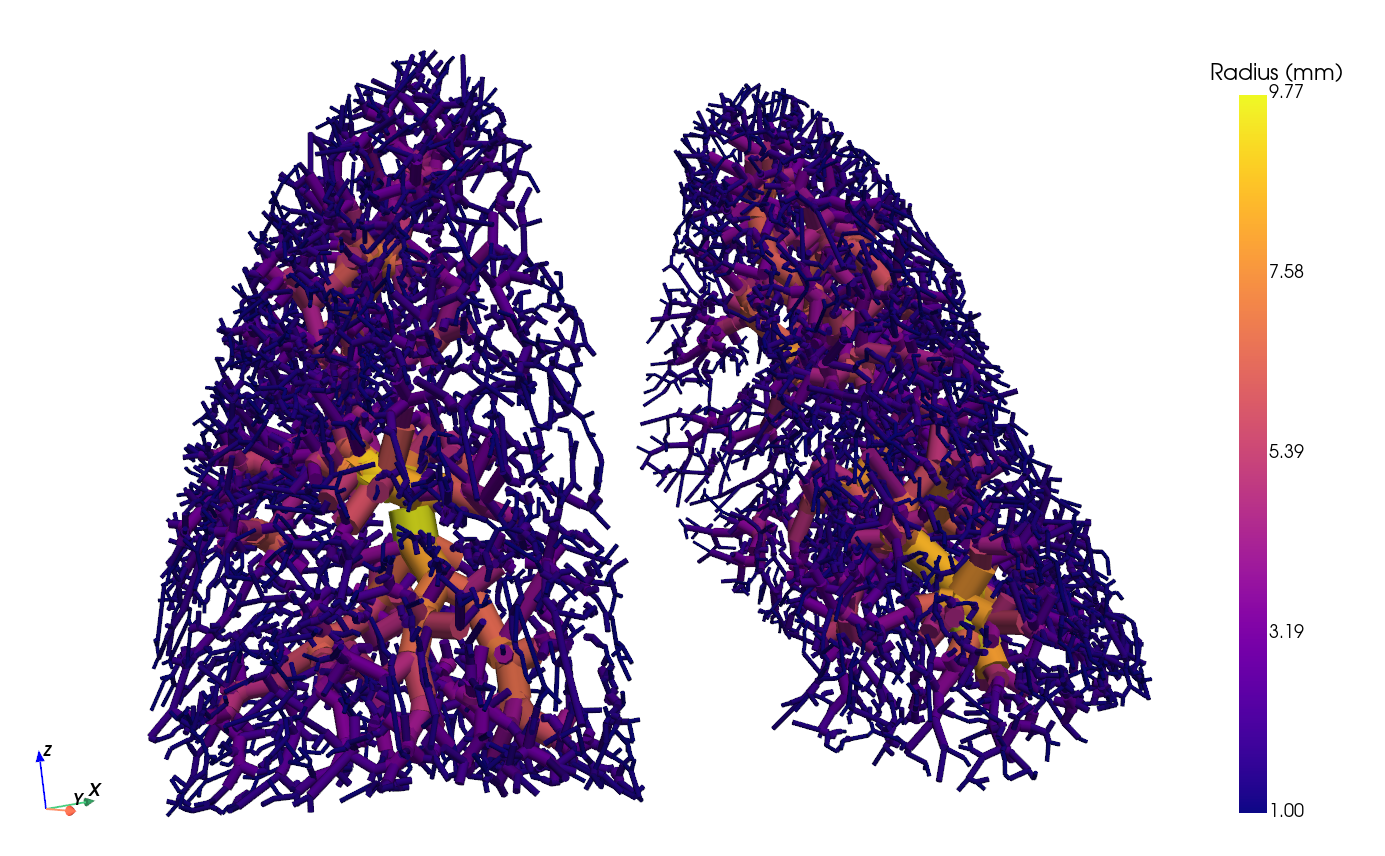 Figure 4: Final pulmonary vascular graph reconstructed.