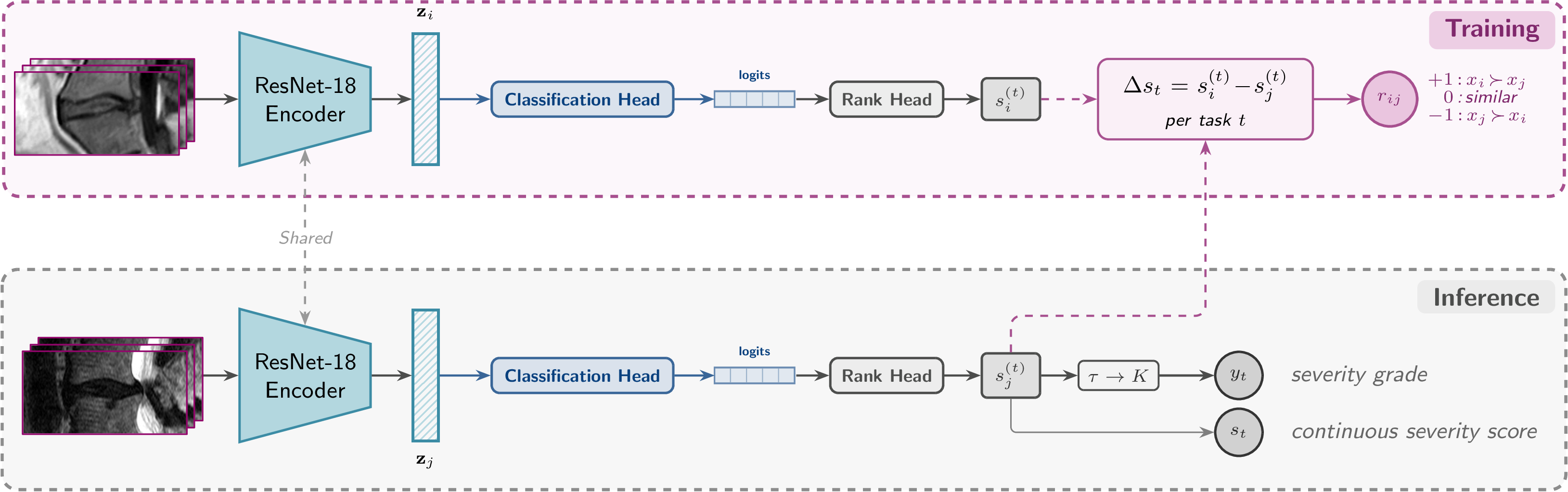 Figure 1: Multi-task architecture for joint classification and ranking. A shared 3D ResNet-18 encoder produces an embedding \mathbf{z}, followed by task-specific classification and ranking heads. Each ranking head outputs a continuous severity score s^{(t)} \in[0,10]; for clarity, the figure shows one representative task head, though there are heads for each of the 11 spinal grading tasks. Pairwise supervision is derived from ground-truth grade orderings and optimized with a severity-aware hinge loss.