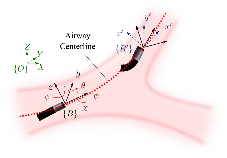 Figure 3: A schematic of reduced-order model of bronchoscopy. An inertial coordinate frame O is fixed at the entry point of the bronchoscope into the airways at the beginning of the trachea, with the bronchoscope tip position represented by \mathbf{p}=[ x, \;y, \;z,]^T. The operator bends the tip of the bronchoscope (\theta) and can twist the bronchoscope to change the plane of bending (\phi), allowing navigation through 3D airway structures. A local body-fixed frame B is attached to the bronchoscope tip, initially coinciding with the inertial frame.