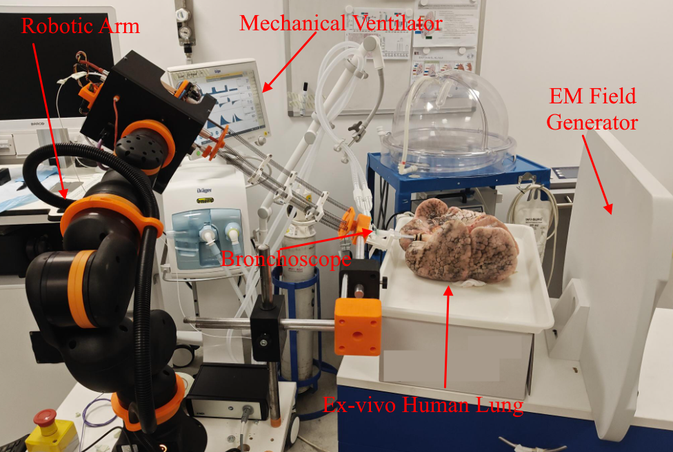 Figure 6: Experimental setup for bronchoscopy validation. A commercial bronchoscope is mounted on a 6-DoF Igus ReBeL robotic arm, which inserts and retracts the scope along Cartesian paths into an ex-vivo mechanically ventilated human lung. Joystick commands drive arm motion, while a custom actuation unit at the end-effector provides 2-DoF control of bronchoscope bending (\theta) and rotation (\phi). The lung is placed within the magnetic field of an Aurora (NDI) EMT system, with a miniature EM sensor inserted at the bronchoscope tip to provide ground-truth pose for evaluation. A total of eight trajectories were executed across all lobes, with lengths ranging from 30 s to 5 min.