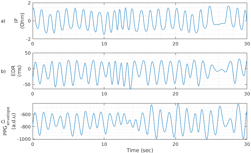 Figure 10: Examples of respiratory signals extracted from synchronised physiological recordings and used for machine learning. a) IP waveform b) ECG-derived respiration (EDR), and c) the PPG-derived respiratory envelope.