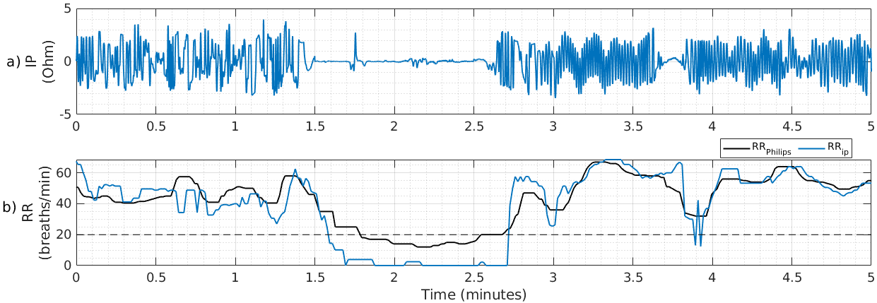 Figure 2: RR estimation using the breath counting method on a 5-minute segment of the IP signal containing a COBE episode (approximately 1.6–2.7 mins): a) Filtered IP waveform; b) comparison of the recomputed respiratory rate (RR_{ip}) and the monitor-provided respiratory rate (RR_{philips}) during a period containing COBE. RR_{philips} exhibits reduced short-term variability, consistent with temporal averaging.