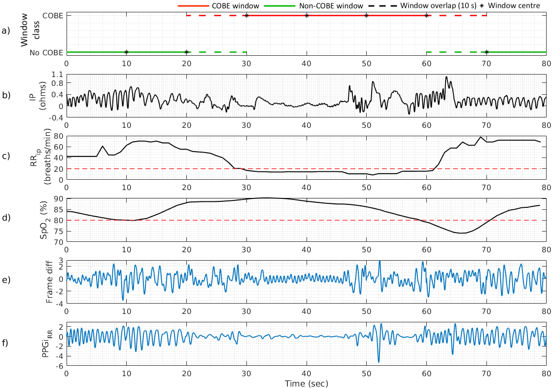 Figure 4: Camera-derived respiratory signals extracted from a neonatal video recording, showing an example segment containing periods of normal breathing and a COBE episode. a) Overlapping 20-second analysis windows assigned binary class labels of COBE (red) or non-COBE (green). Black asterisks indicate the centres of consecutively labelled windows (10-s step size), while the coloured horizontal lines show the temporal extent of the corresponding analysis windows. Dashed line segments indicate the 10-s overlap between adjacent analysis windows. b) filtered IP signal; c) RR_{ip} signal showing a respiratory pause. The red dashed line indicates the 20 breaths/min threshold used during COBE annotation; d) SpO_{2} signal showing a period of desaturation. The red dashed line indicates the 80% threshold used during COBE annotation; e) FD signal; f) PPGi_{rr} signal.