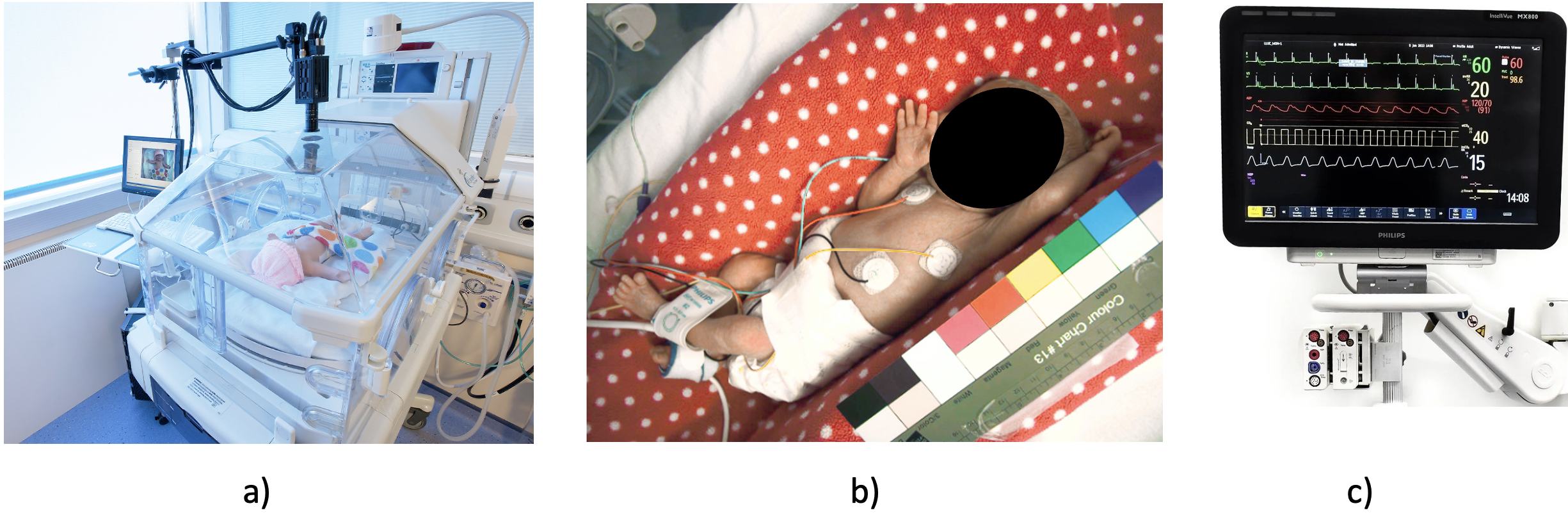 Figure 1: Components of the data acquisition setup used for synchronised video and physiological monitoring in the NICU. a) Video camera positioned through a modified opening in the incubator canopy; b) Representative video frame acquired during monitoring; c) Representative Philips patient monitor with SpO_2 measurement modules.