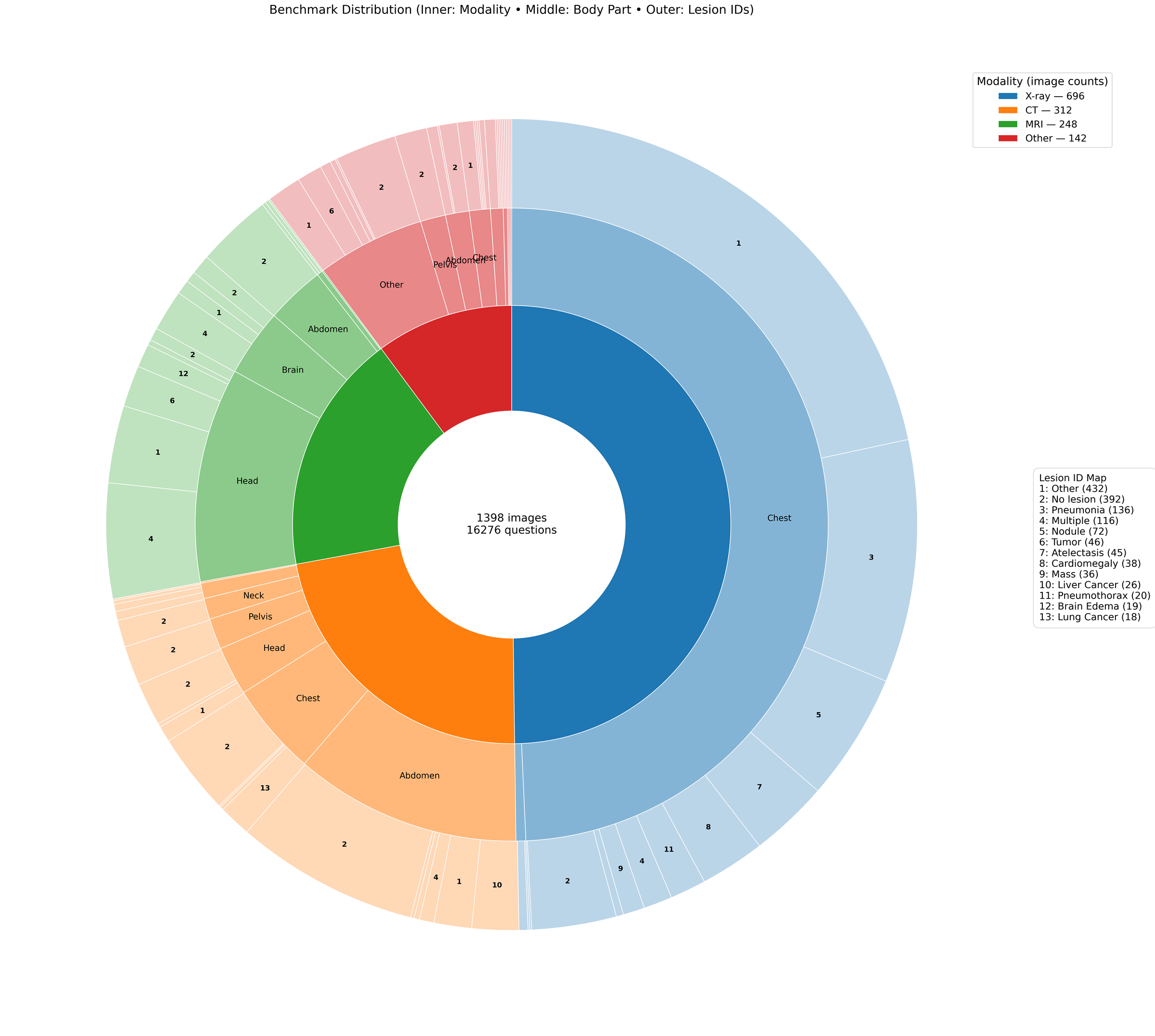 Figure 10: Benchmark distribution (inner ring: modality; middle ring: body part; outer ring: lesion IDs). Center reports global counts (#images, #questions).