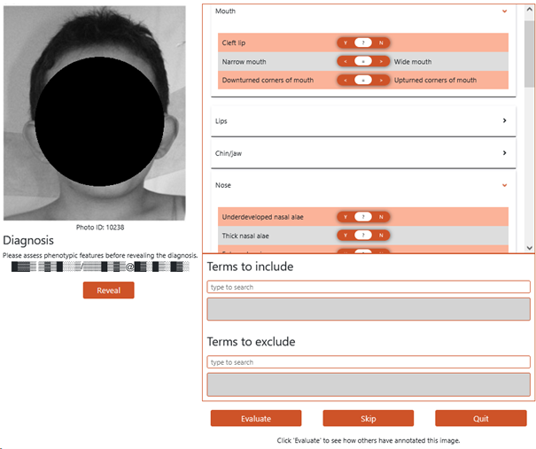 Figure 1: Face2HPO annotation tool with the patient’s face obfuscated.