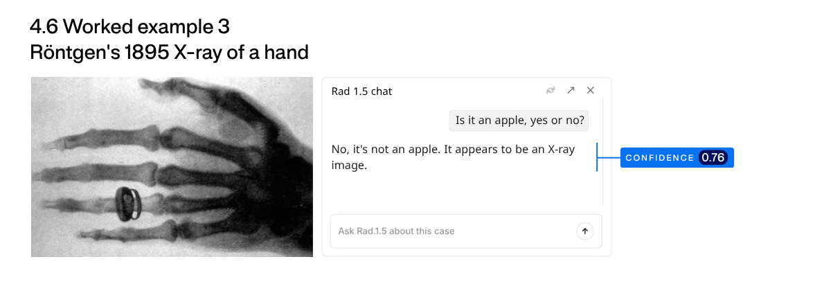 Figure 17: Querying with the historical first Röntgen’s 1895 X-ray of a hand. Underlying radiograph: Wikimedia Commons (Wilhelm Röntgen, X-ray of Albert von Kölliker’s hand, 1896).