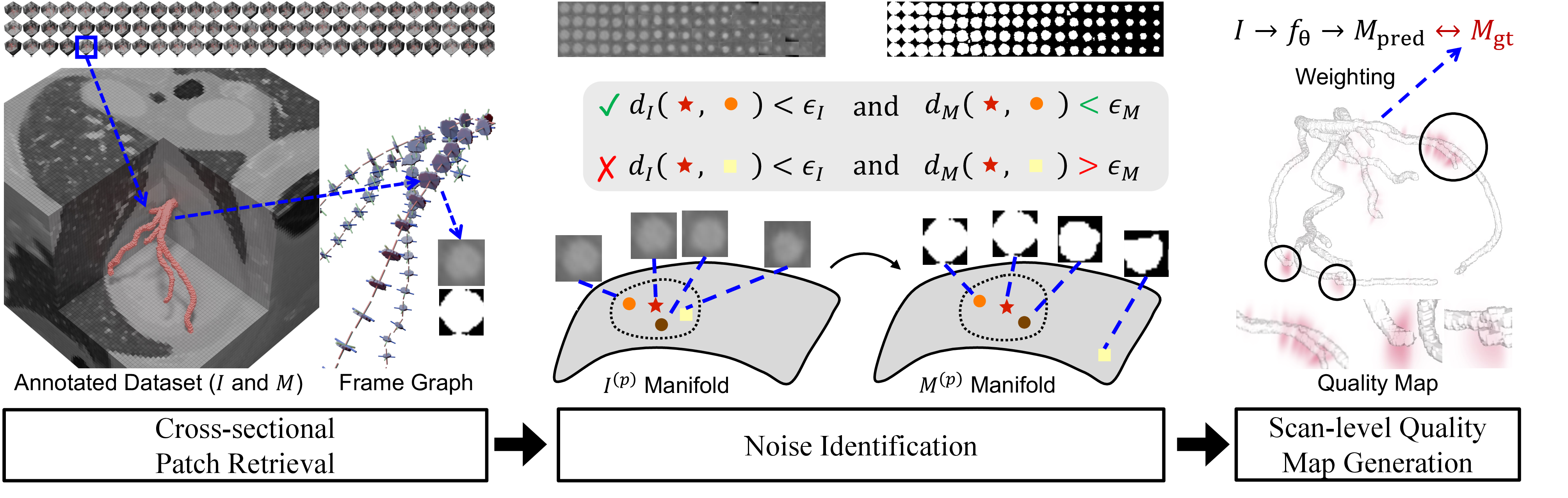 Figure 1: Overview of the proposed method. Left: Cross-sectional patches are extracted along Bishop frames of vessel centrelines, and visually similar patches are retrieved across subjects. Middle: For each patch, its mask is compared with those of its intensity-equivalent neighbours. If any neighbour has a highly similar image but a substantially different mask, at least one annotation is potentially noisy. Right: Pair and patch level scores are aggregated into a scan-level quality map for weighted training.