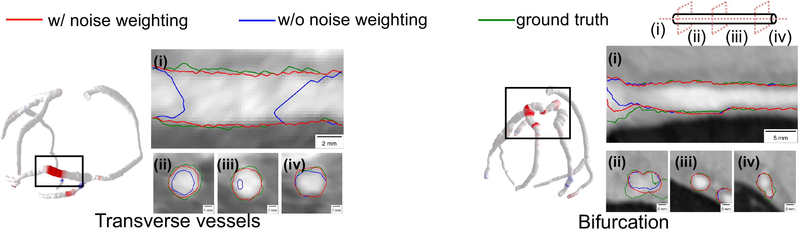 Figure 3: Qualitative comparison on transverse vessels (left) and bifurcations (right), with CPR views (i) and cross-sections (ii–iv).