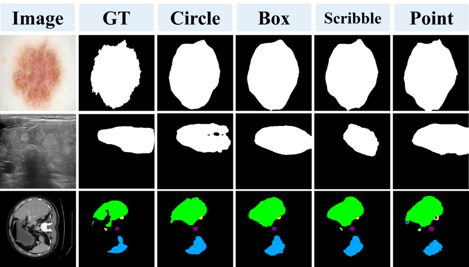 fig: b