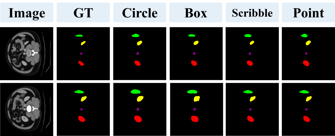 Figure 6: Visualization of multi-organ segmentation on Synapse dataset.