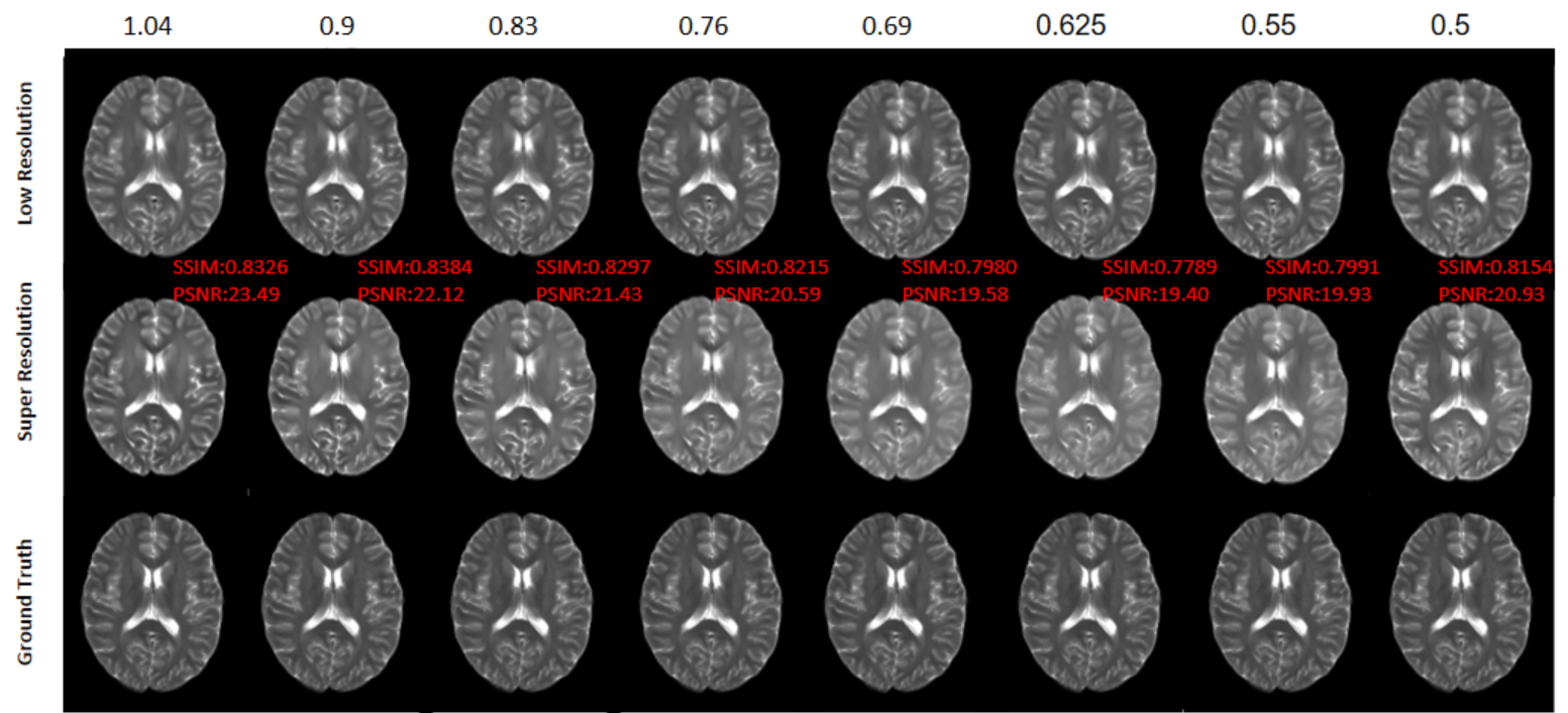 Figure 4: Visual comparison on the real 3T–5T dynamic-resolution dataset. Our method produces reconstructions most consistent with the 5T Ground Truth, with improved structural details and realistic textures.