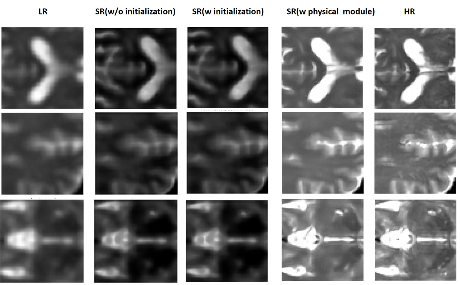 Figure 8: Visual comparison of the ablation study. From left to right: LR input, w/o initialization (w/o Init.), with initialization only (w/ Init.), with initialization and physics module (w/ Init.+ Phy.), and ground truth (GT). The incorporation of the physics module significantly improves the grayscale fidelity and recovers finer structural details that are consistent with the GT.